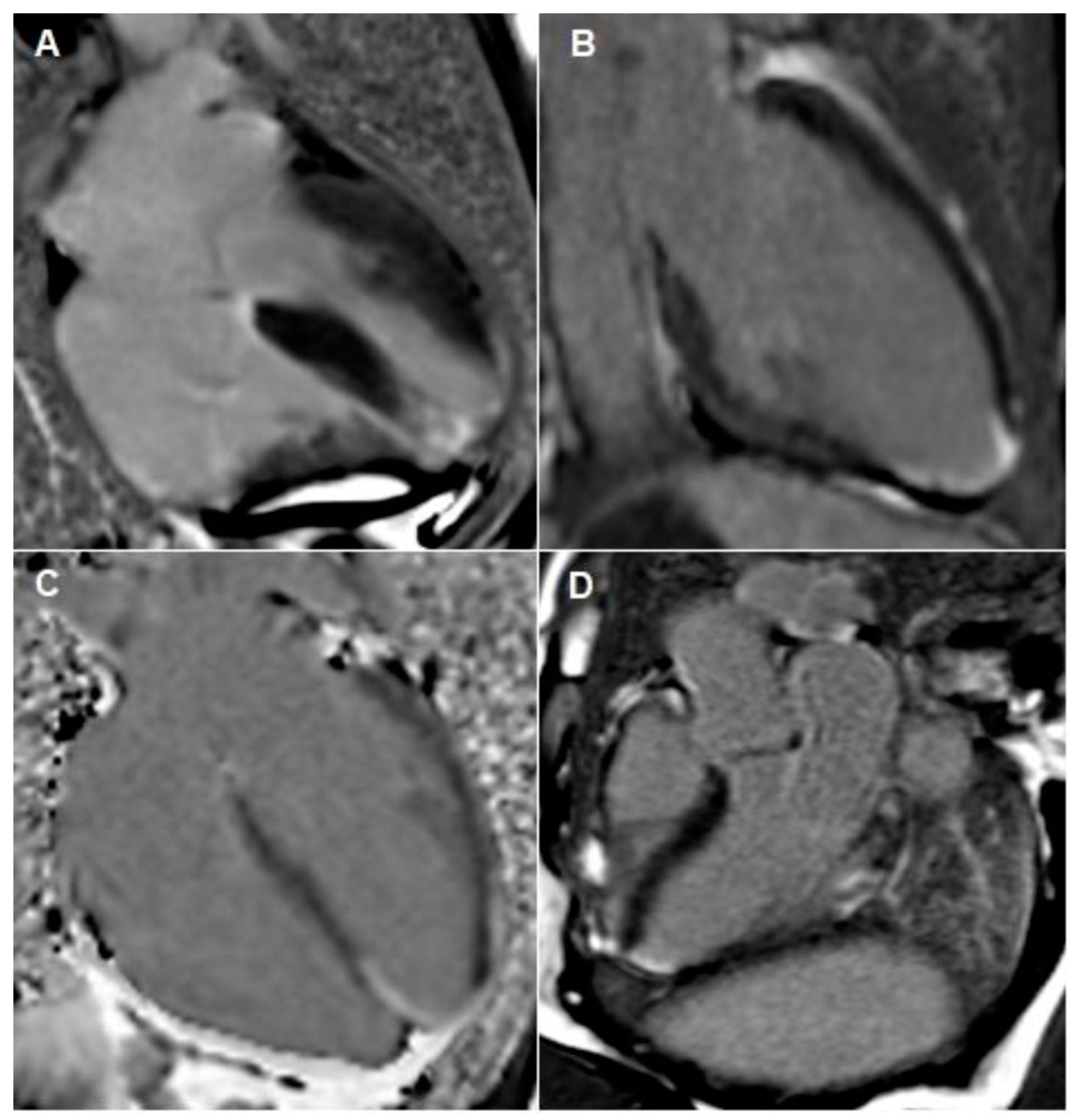 Cardiogenetics 12 00023 g004 550
