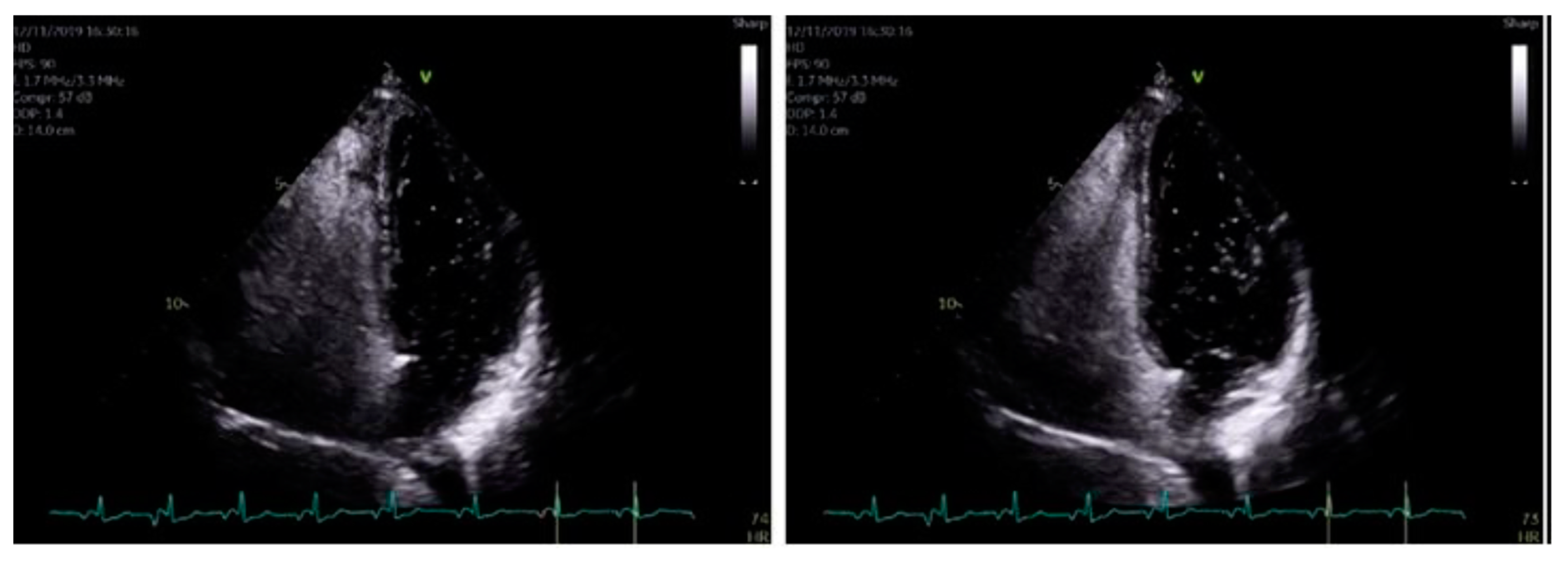 Cardiogenetics 12 00023 g005 550
