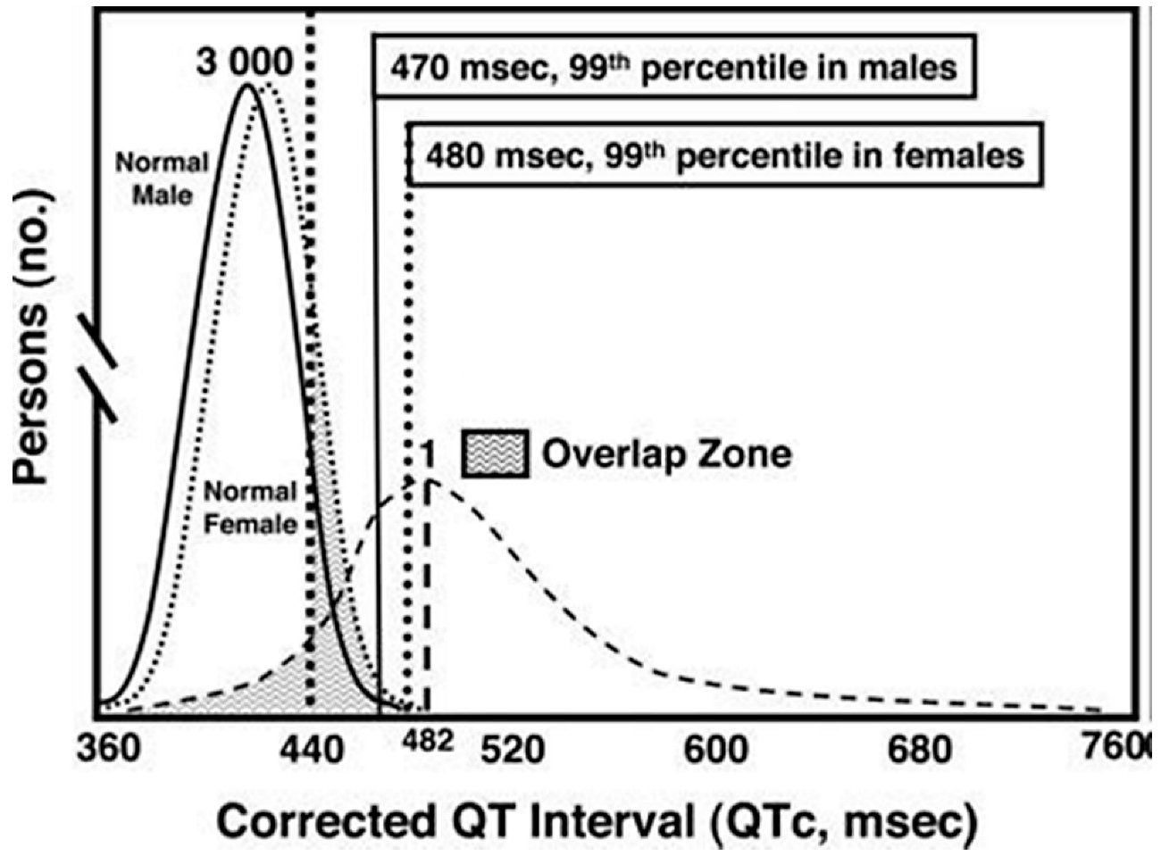 Qtc normal range