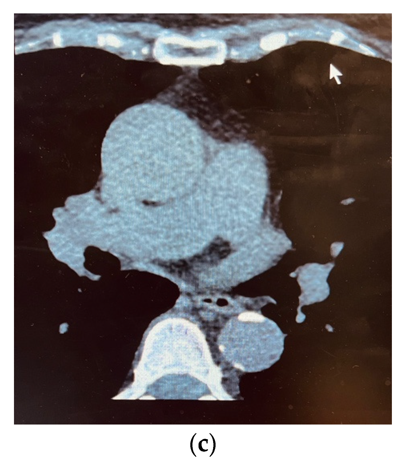 Cardiogenetics 12 00026 g001b Cardiogenetics 12 00026 g001b