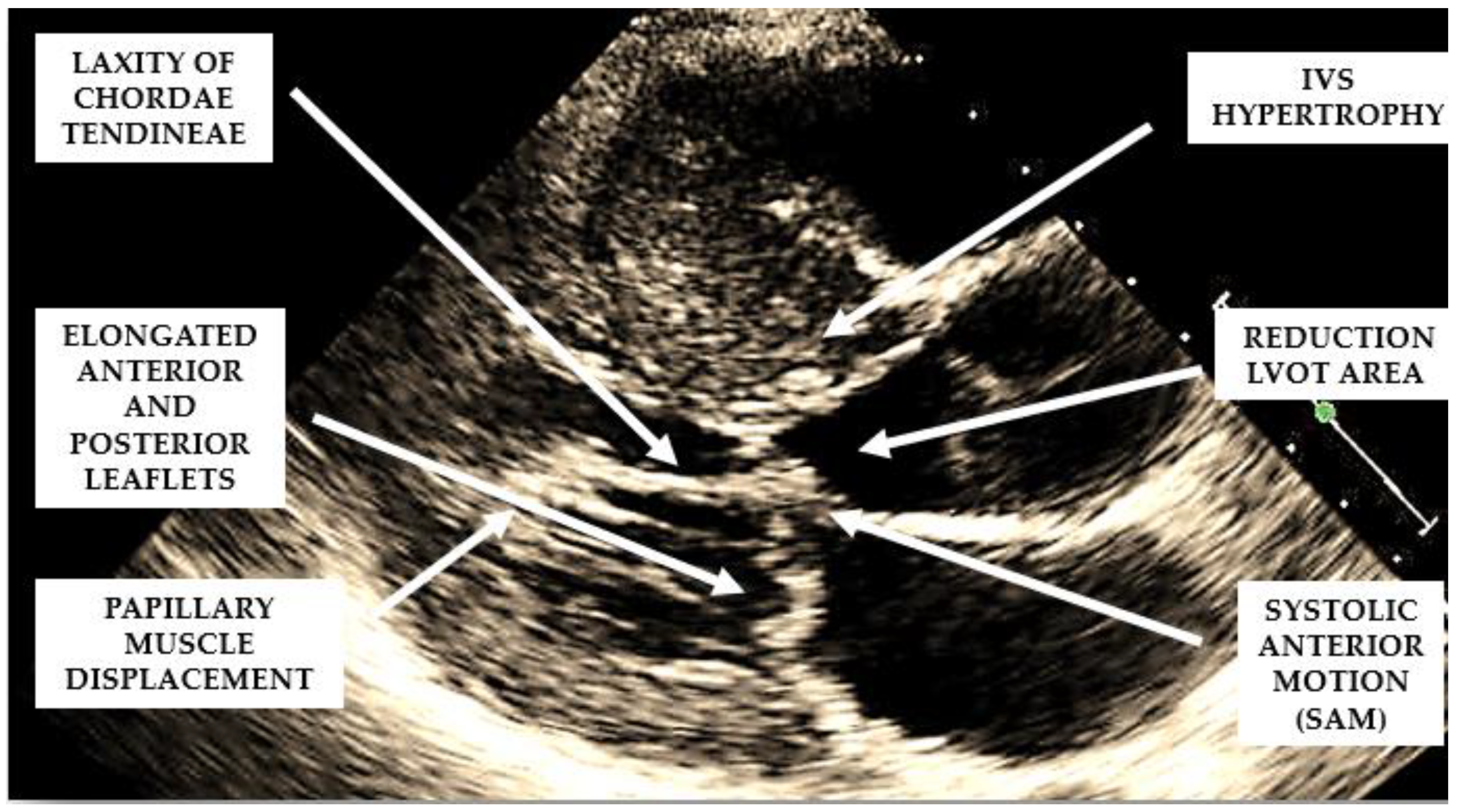 Cardiogenetics 13 00008 g002