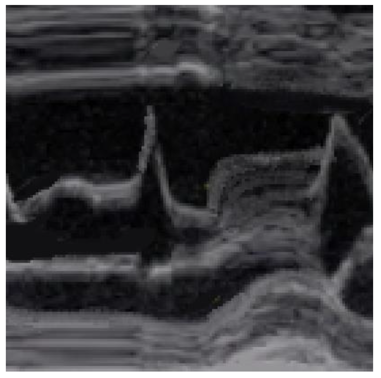 Cardiogenetics 13 00008 g003