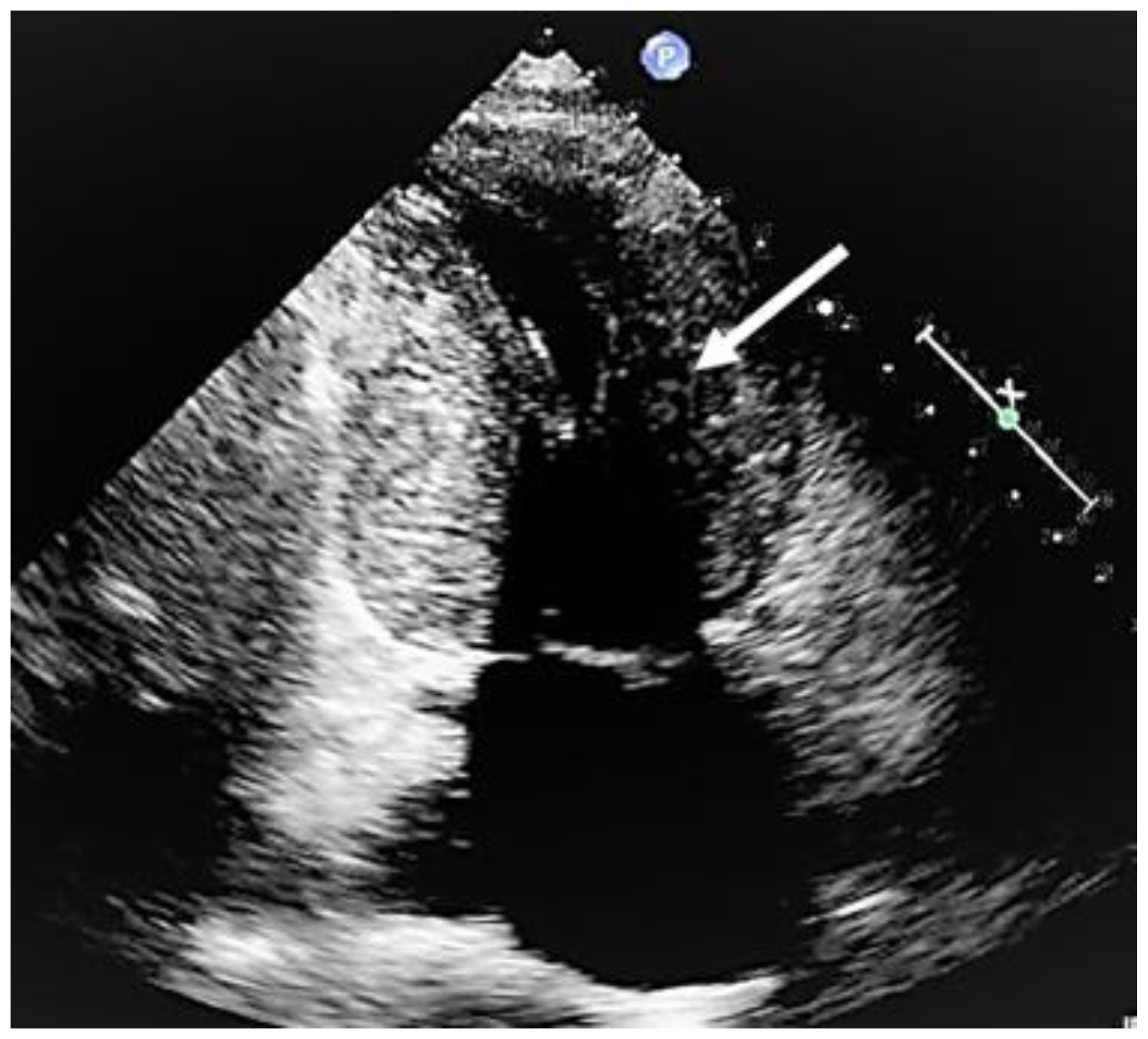 Cardiogenetics 13 00008 g005