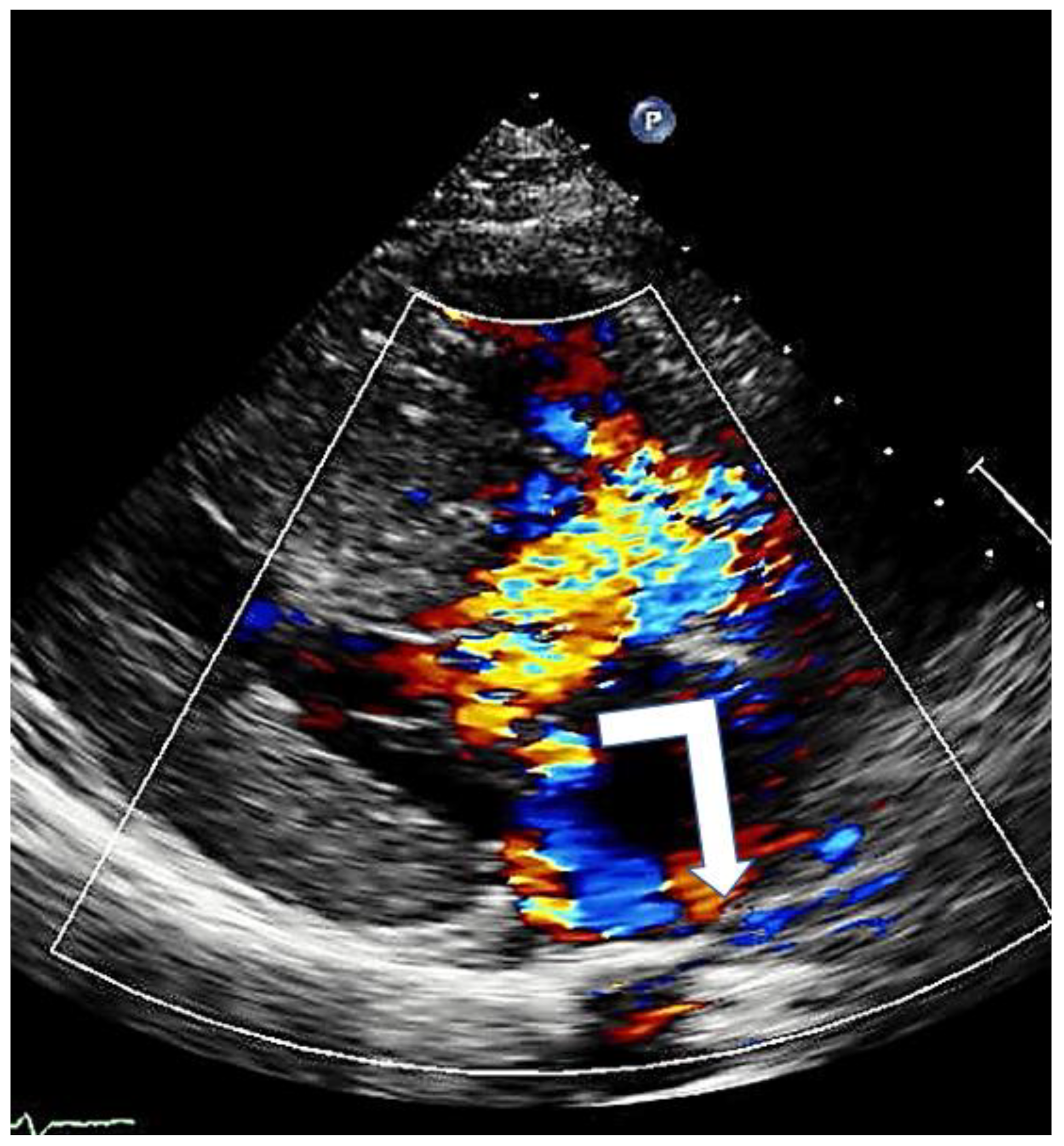 Cardiogenetics 13 00008 g006