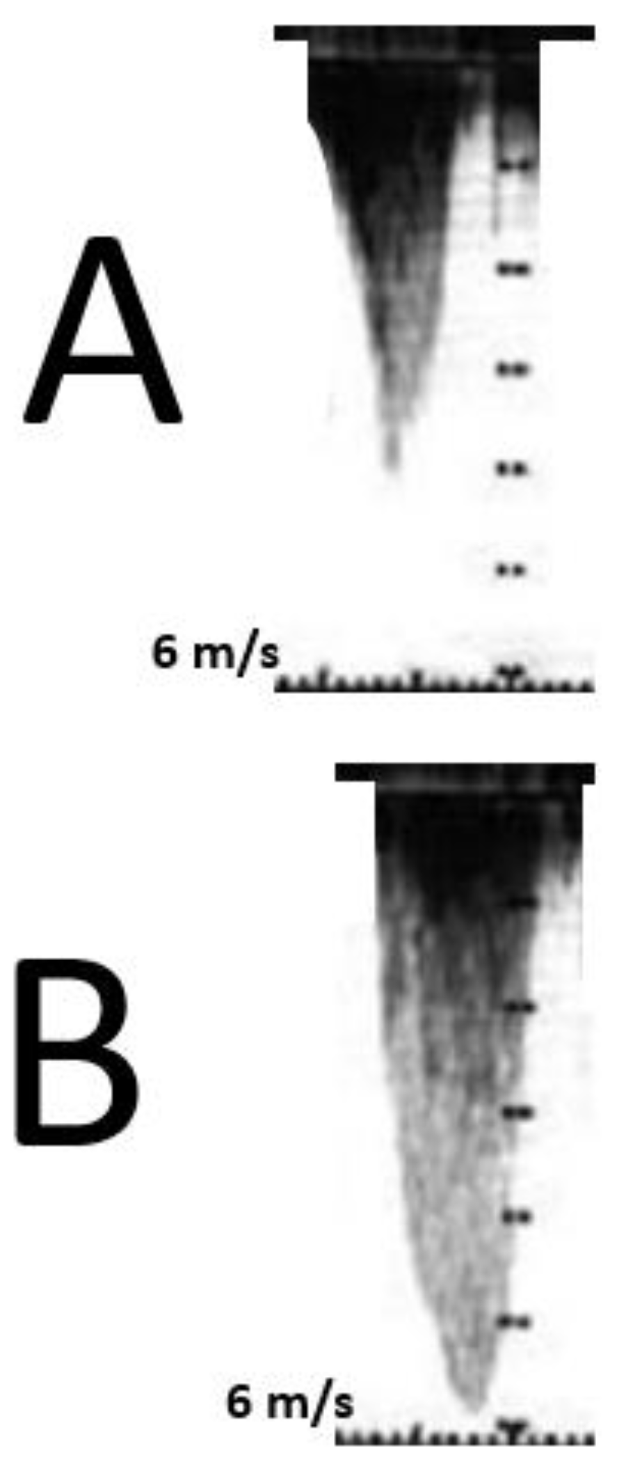 Cardiogenetics 13 00008 g008