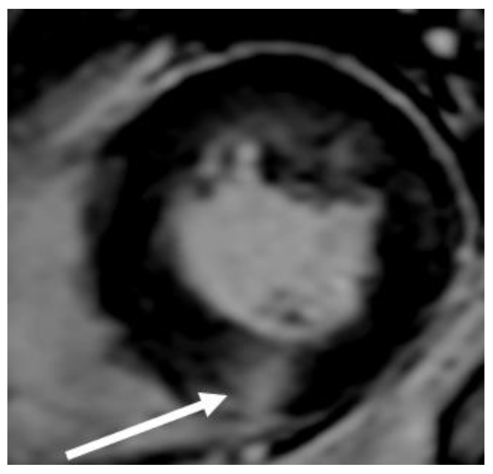 Cardiogenetics 13 00008 g012