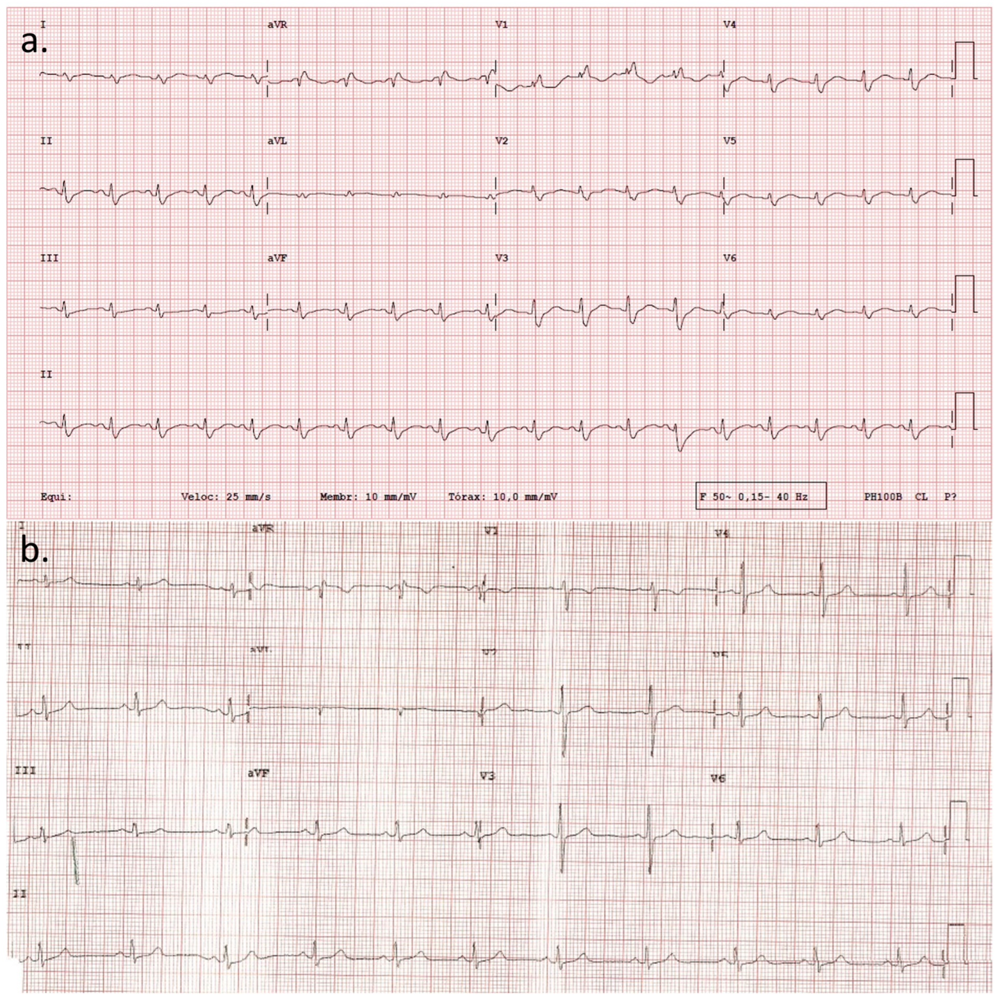 Cardiogenetics 13 00014 g001 Cardiogenetics 13 00014 g001