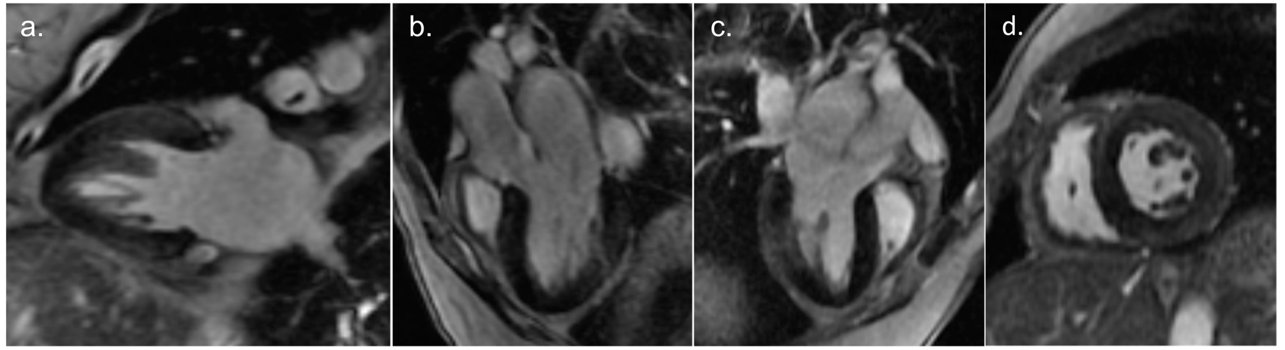 Cardiogenetics 13 00014 g003 Cardiogenetics 13 00014 g003