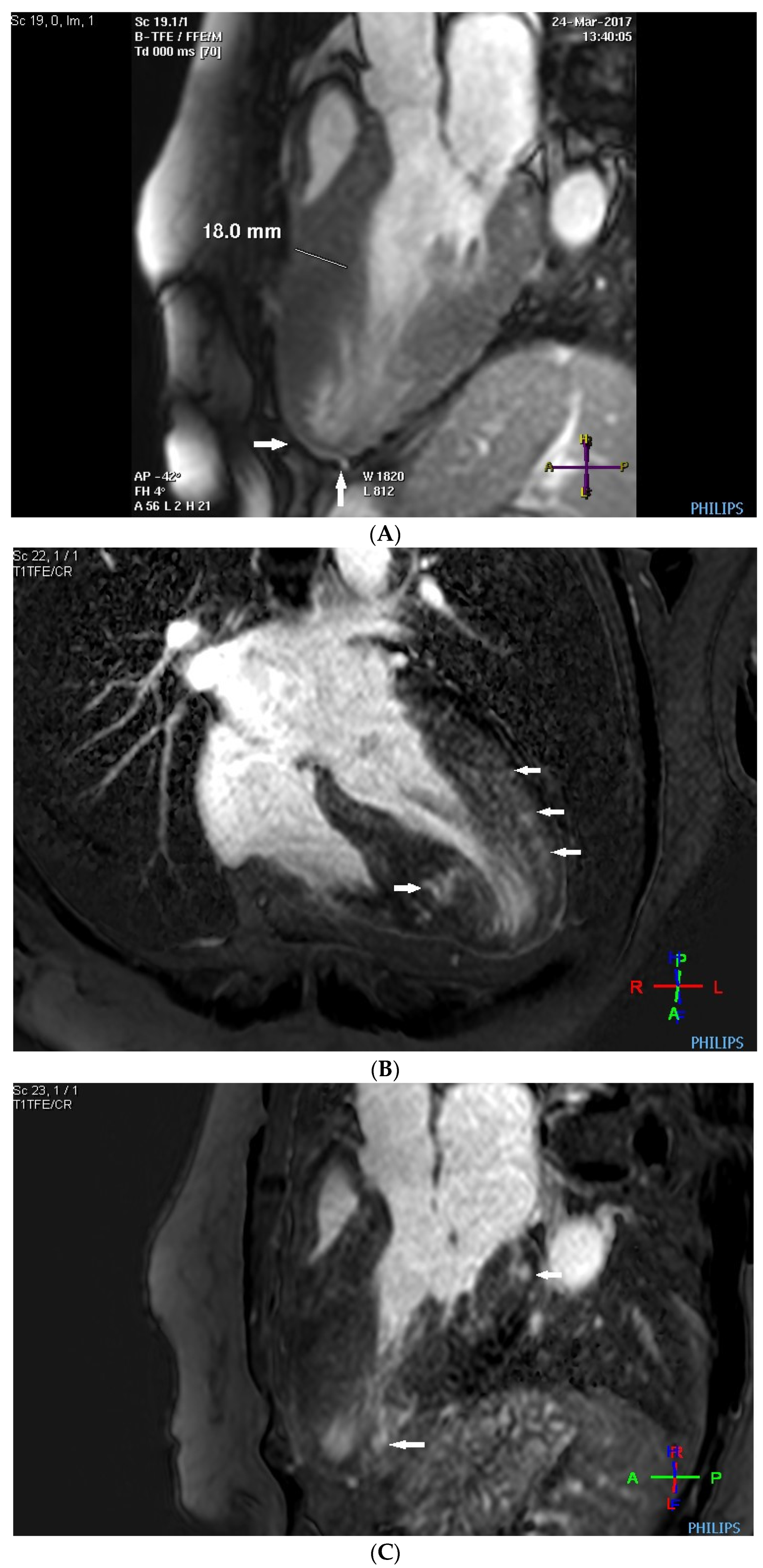 Cardiogenetics 14 00006 g004a