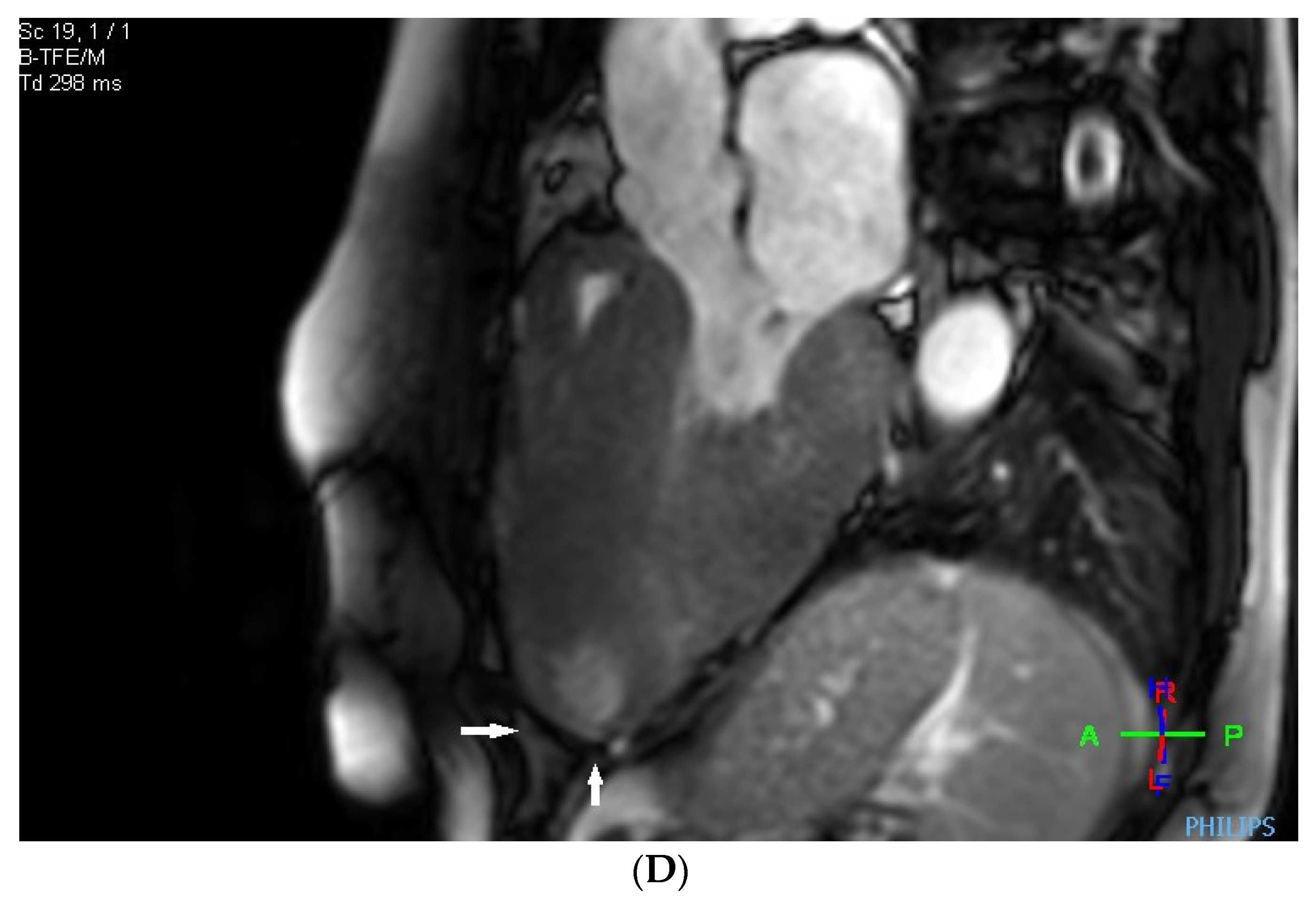 Cardiogenetics 14 00006 g004b