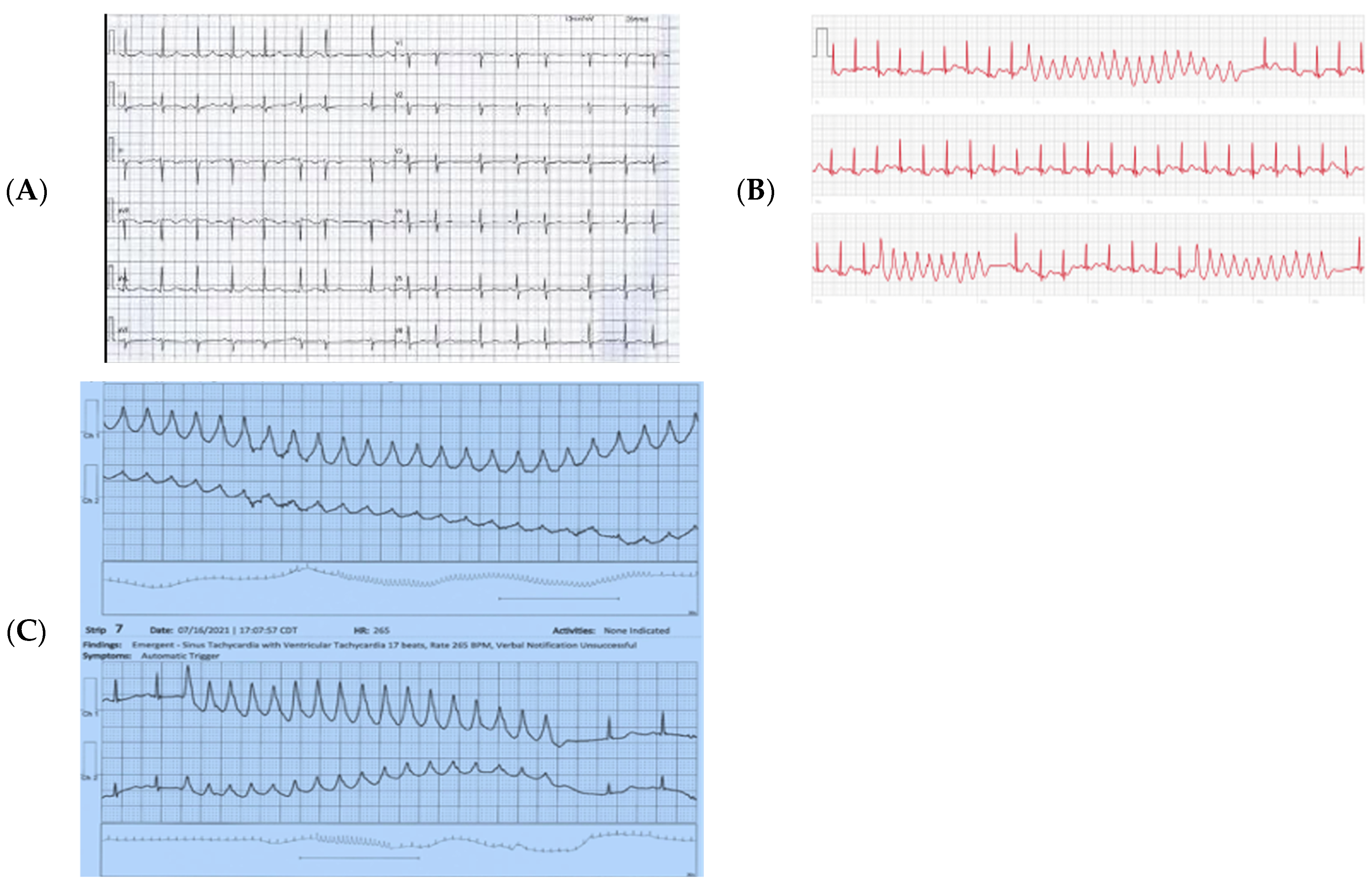 Cardiogenetics 14 00007 g002