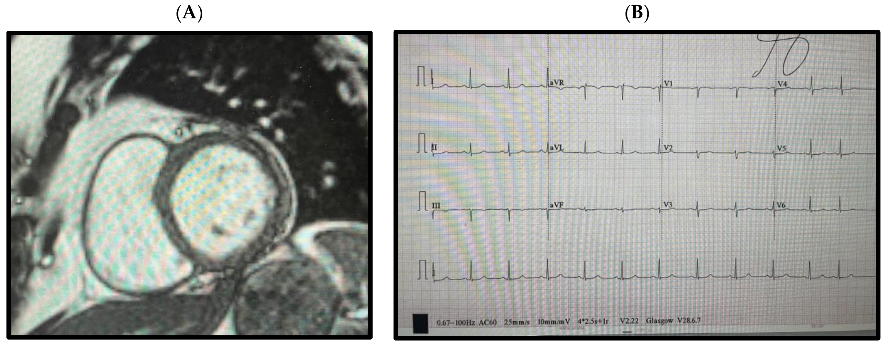 Cardiogenetics 14 00007 g003
