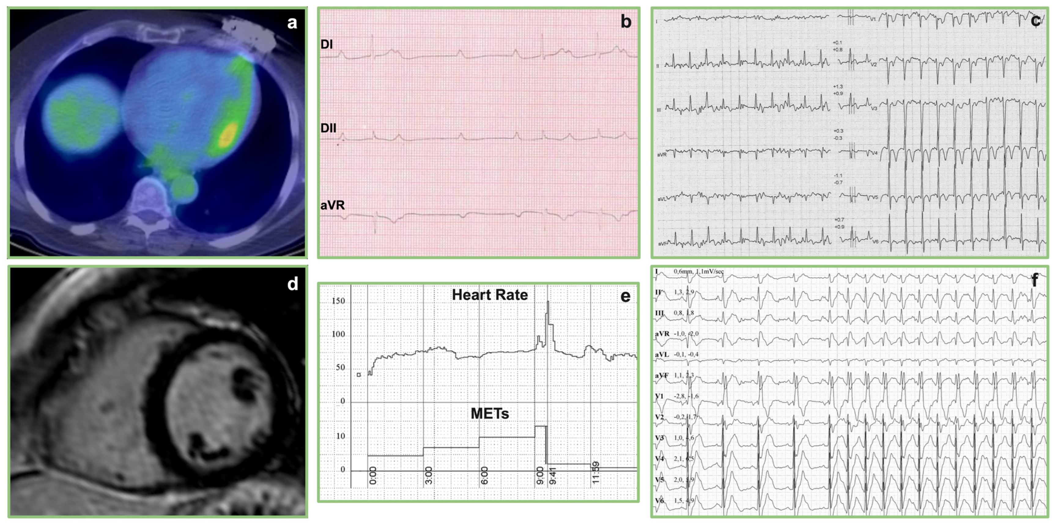 Cardiogenetics 15 00002 g001