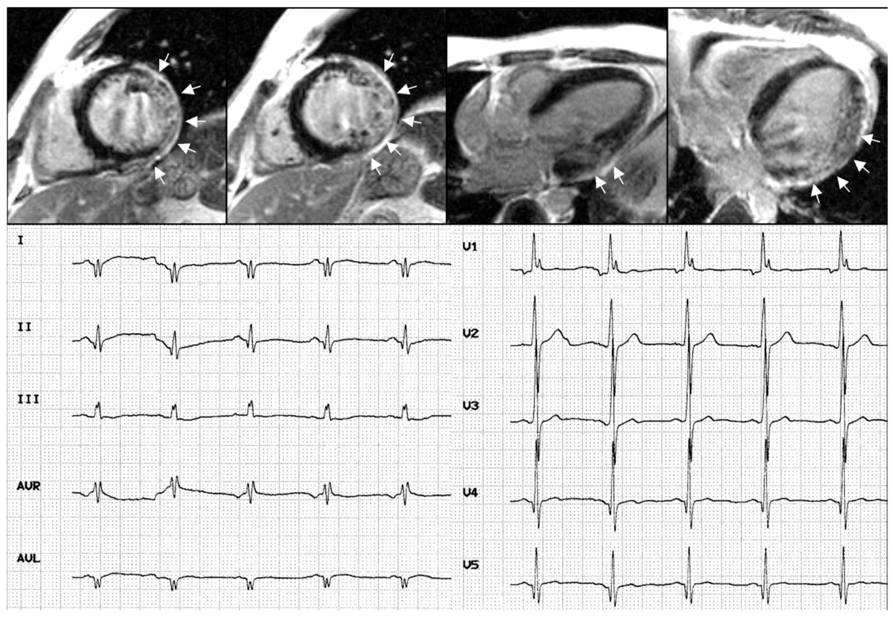 Cardiogenetics 15 00007 g004