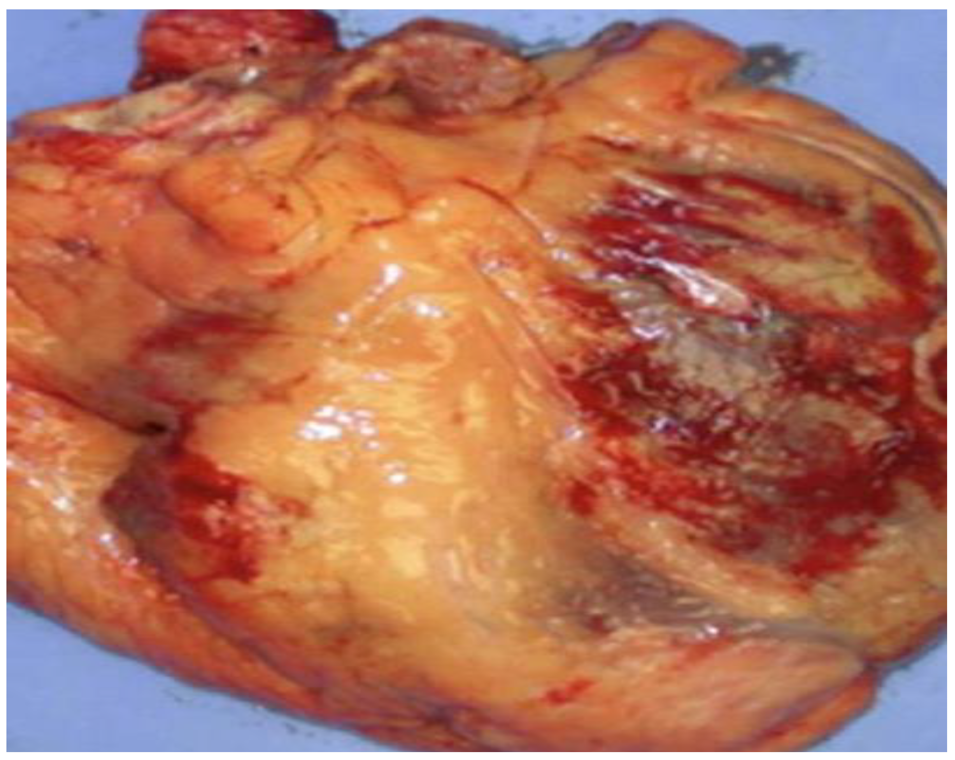 Cardiogenetics 15 00008 g001 Cardiogenetics 15 00008 g001