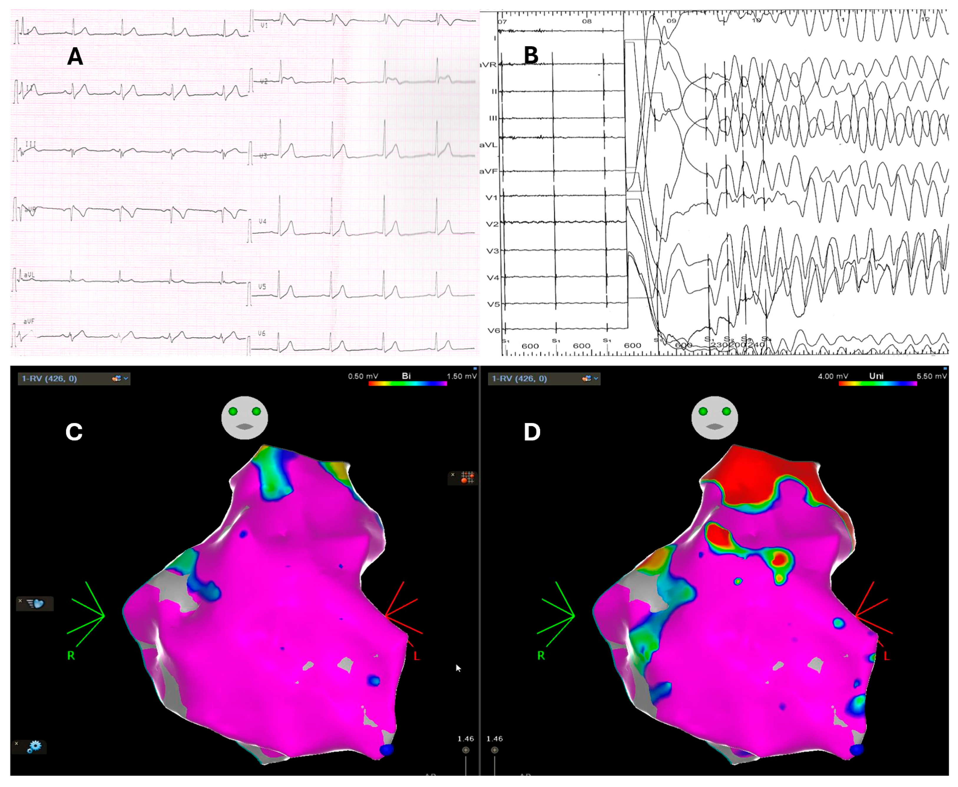 Cardiogenetics 15 00017 g001