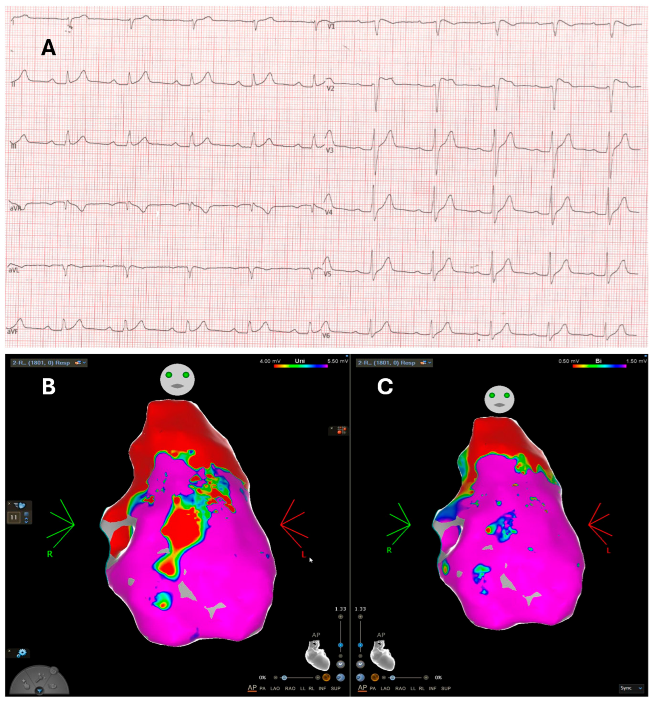 Cardiogenetics 15 00017 g002