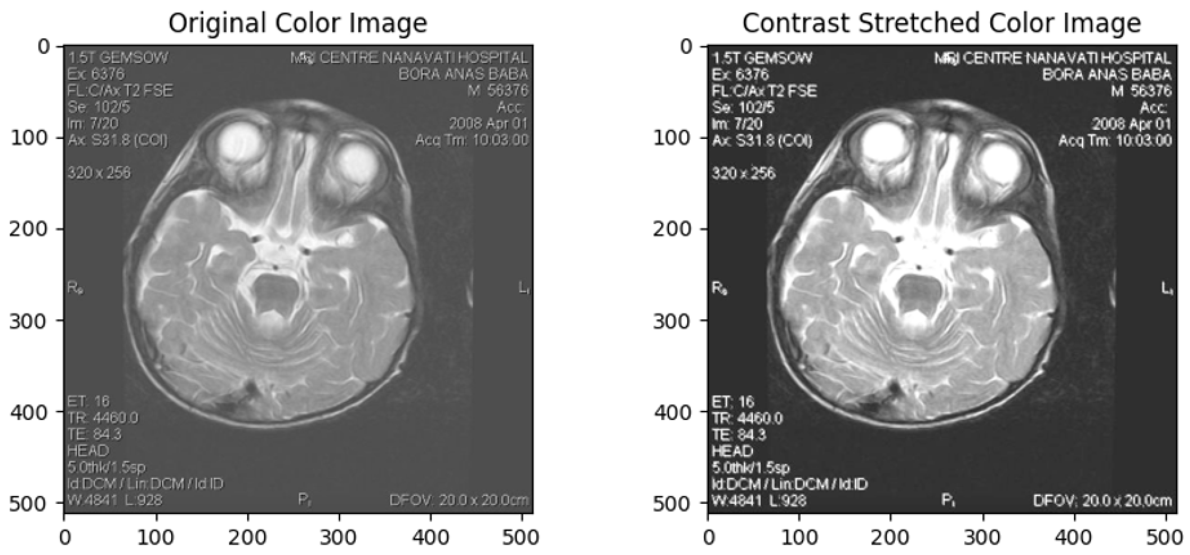 Cardiogenetics 15 00019 g002