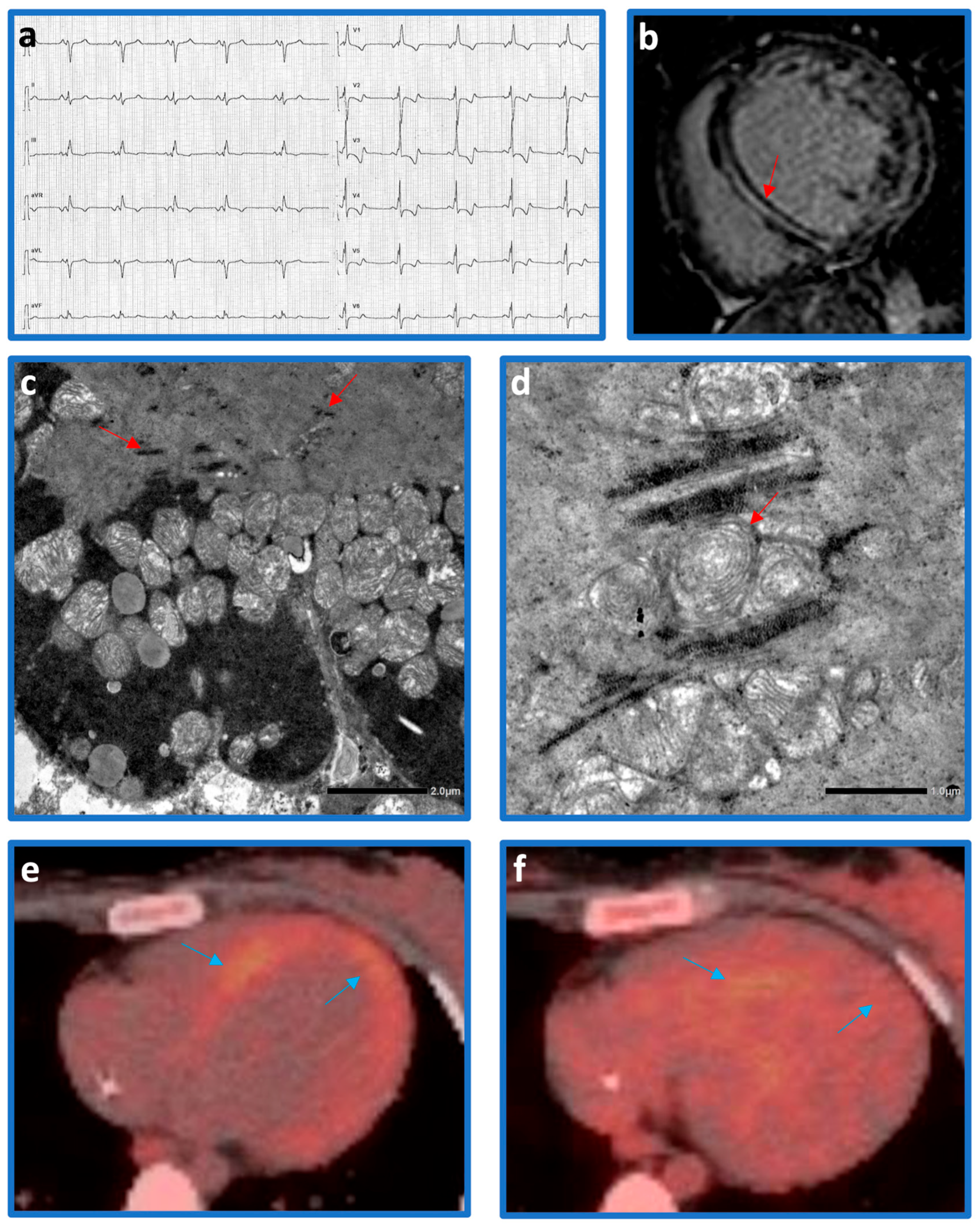 Cardiogenetics 15 00020 g001 Cardiogenetics 15 00020 g001