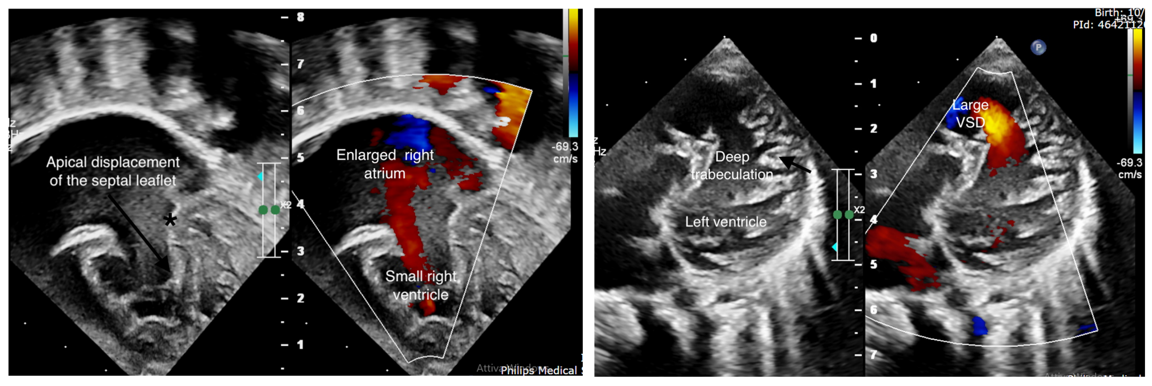 Cardiogenetics 15 00024 g001 Cardiogenetics 15 00024 g001