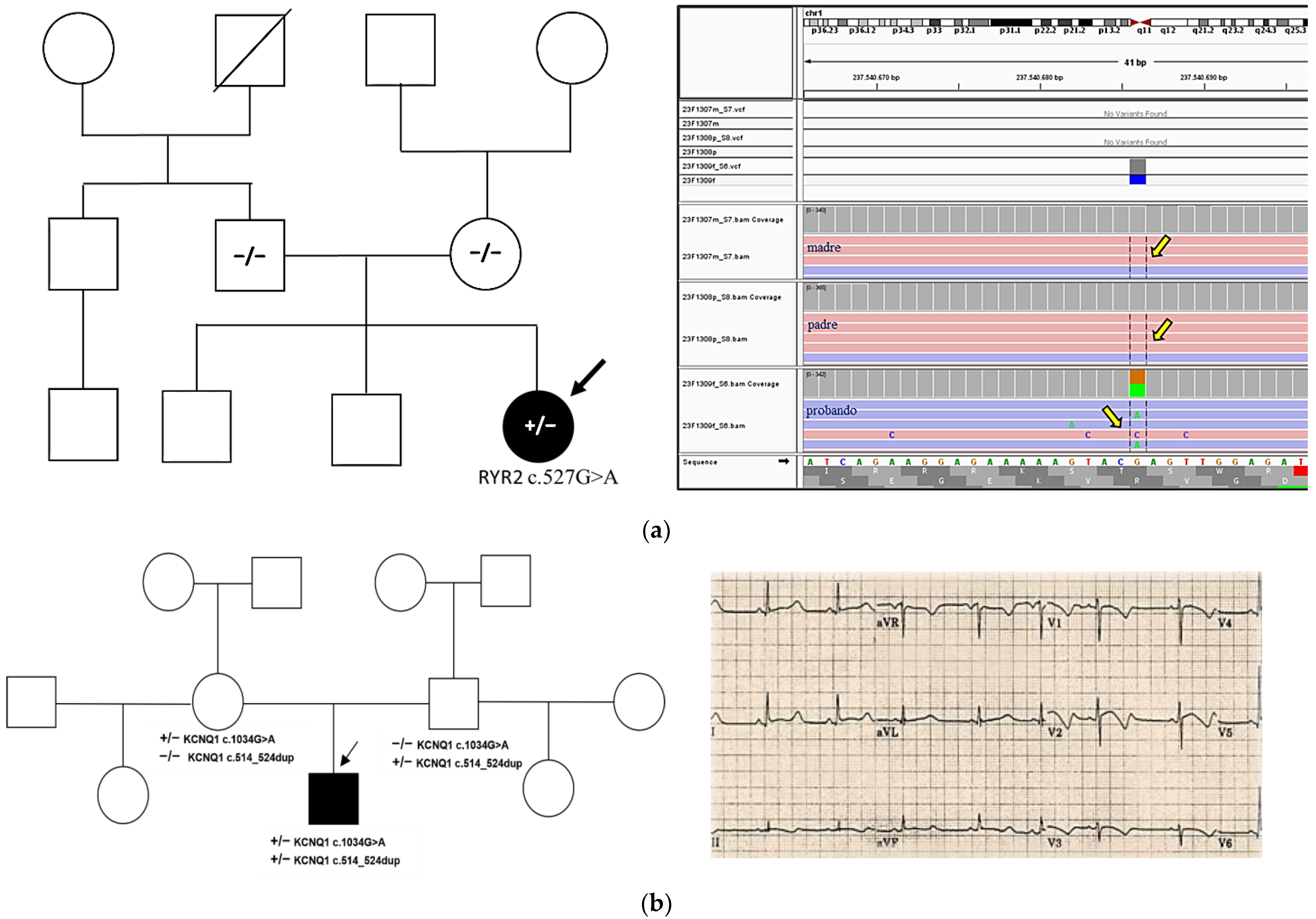 Cardiogenetics 15 00025 g003 Cardiogenetics 15 00025 g003