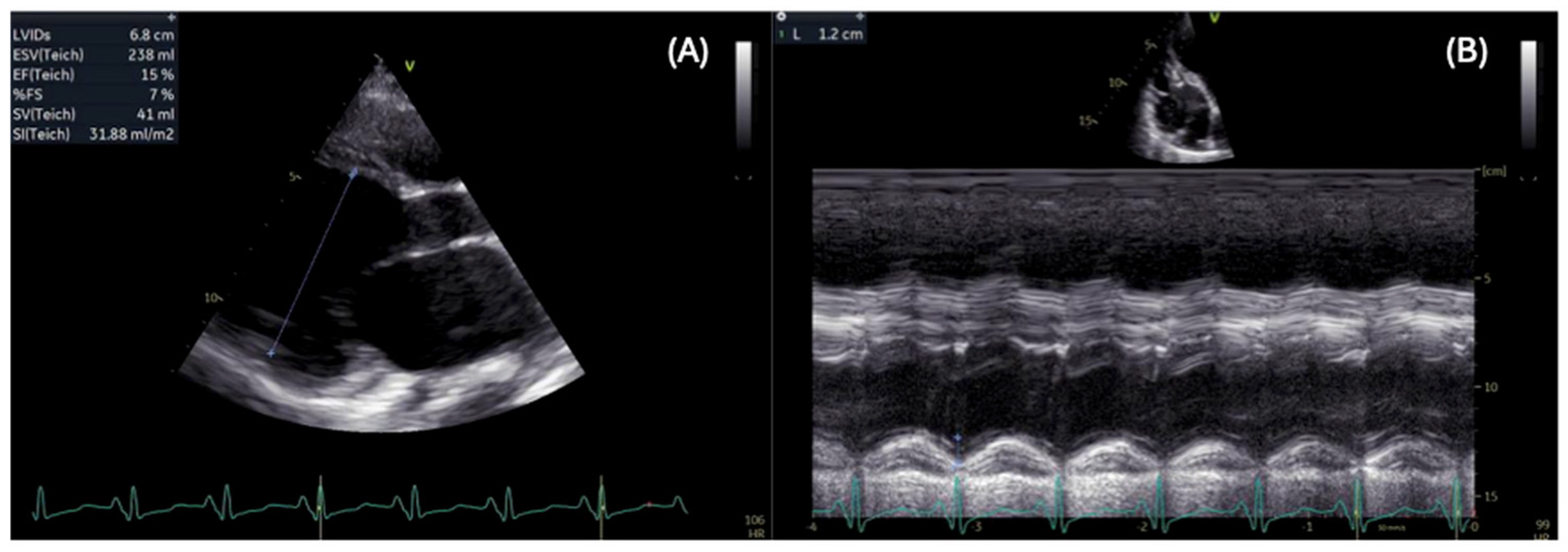 Cardiogenetics 15 00026 g001 Cardiogenetics 15 00026 g001