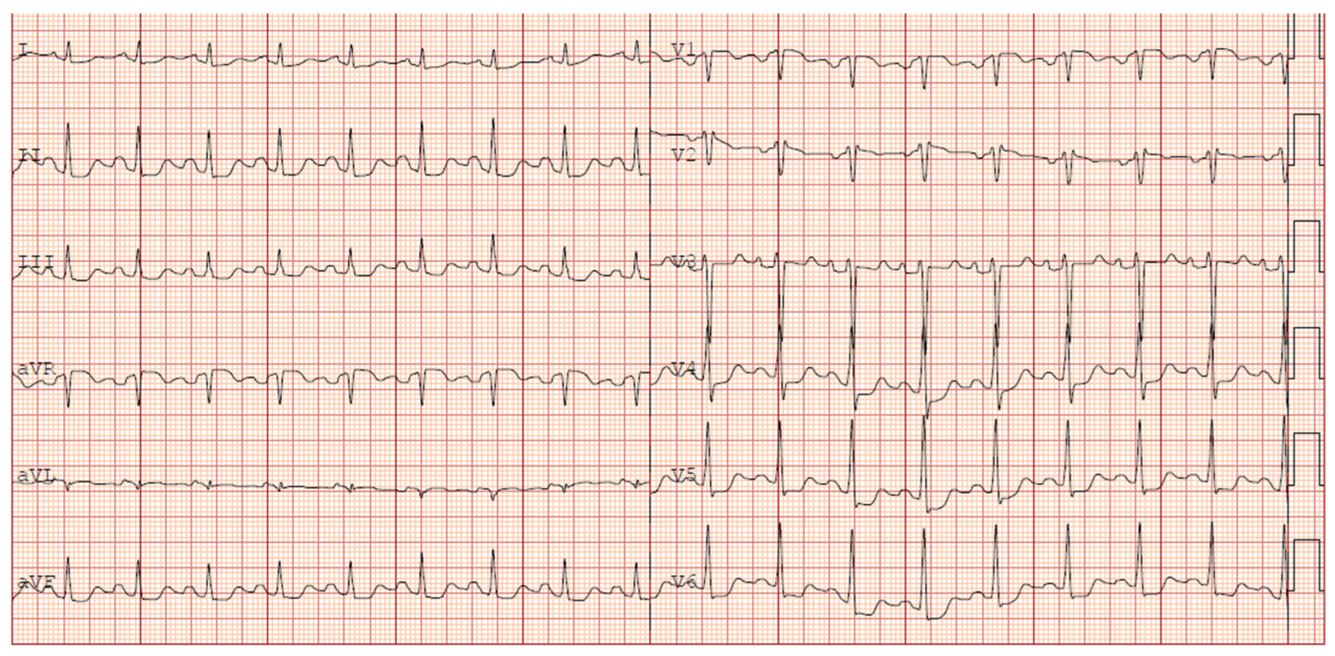 Cardiogenetics 16 00003 g002