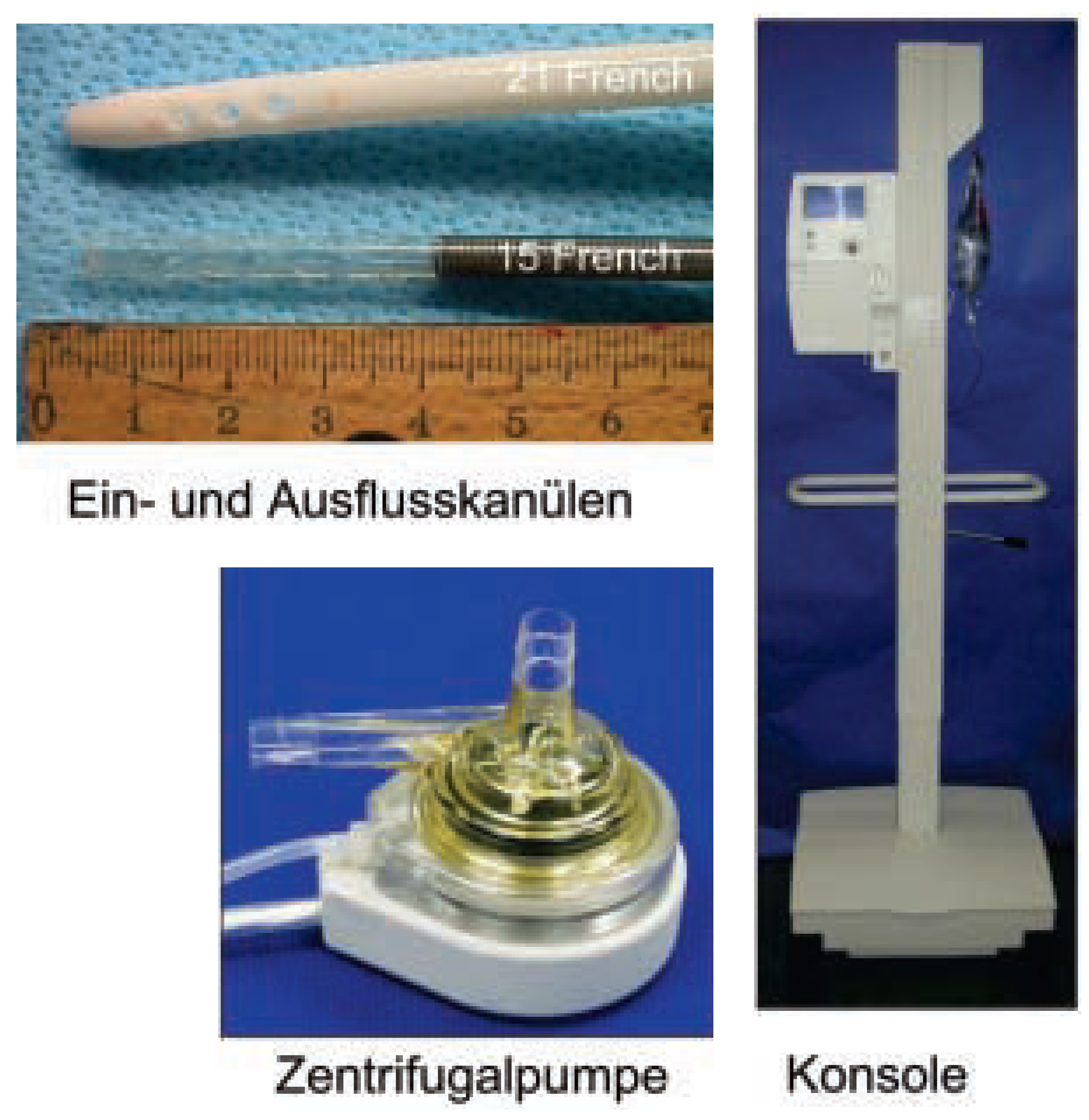 Cardiovascmed 07 00026 g001
