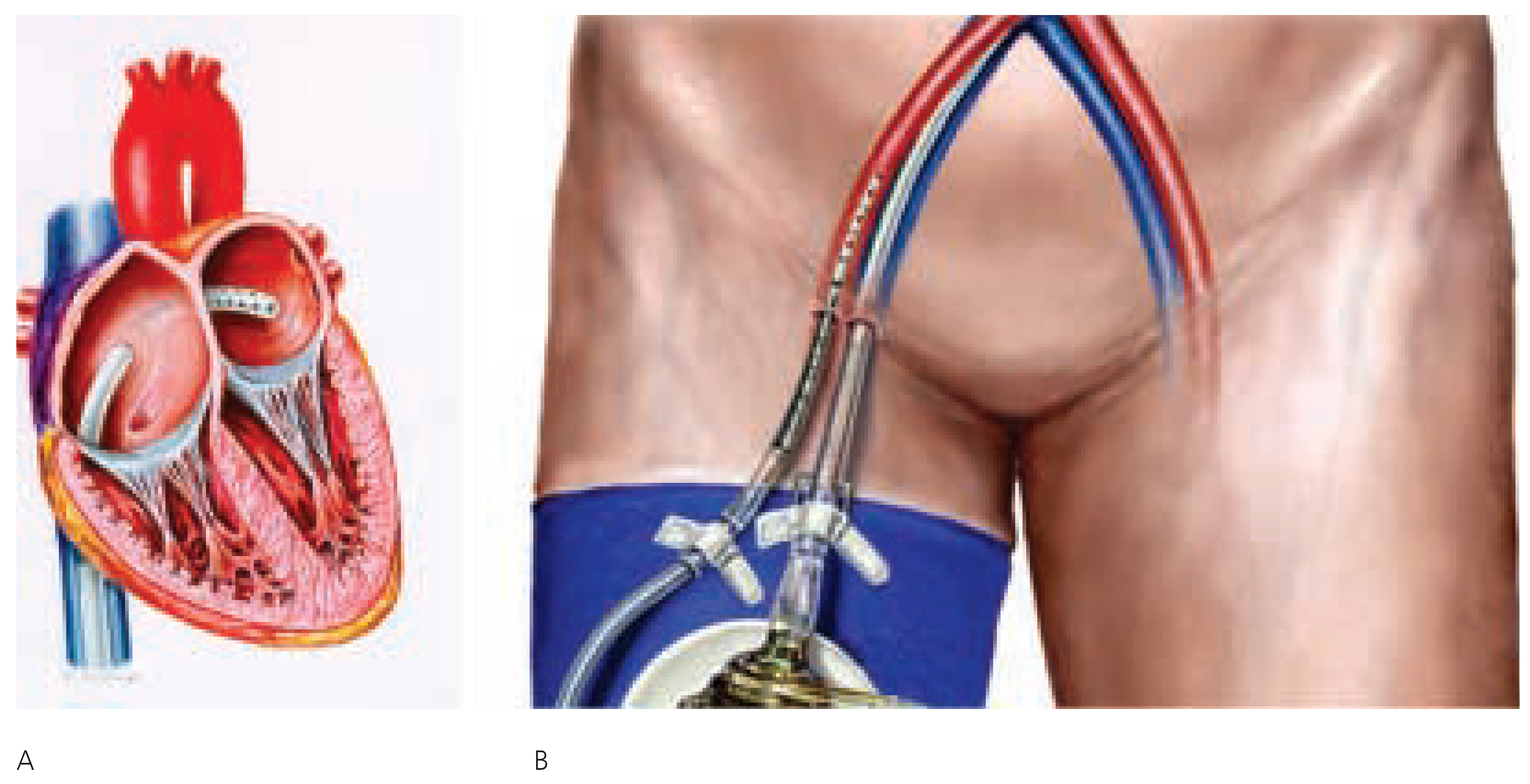Cardiovascmed 07 00026 g002