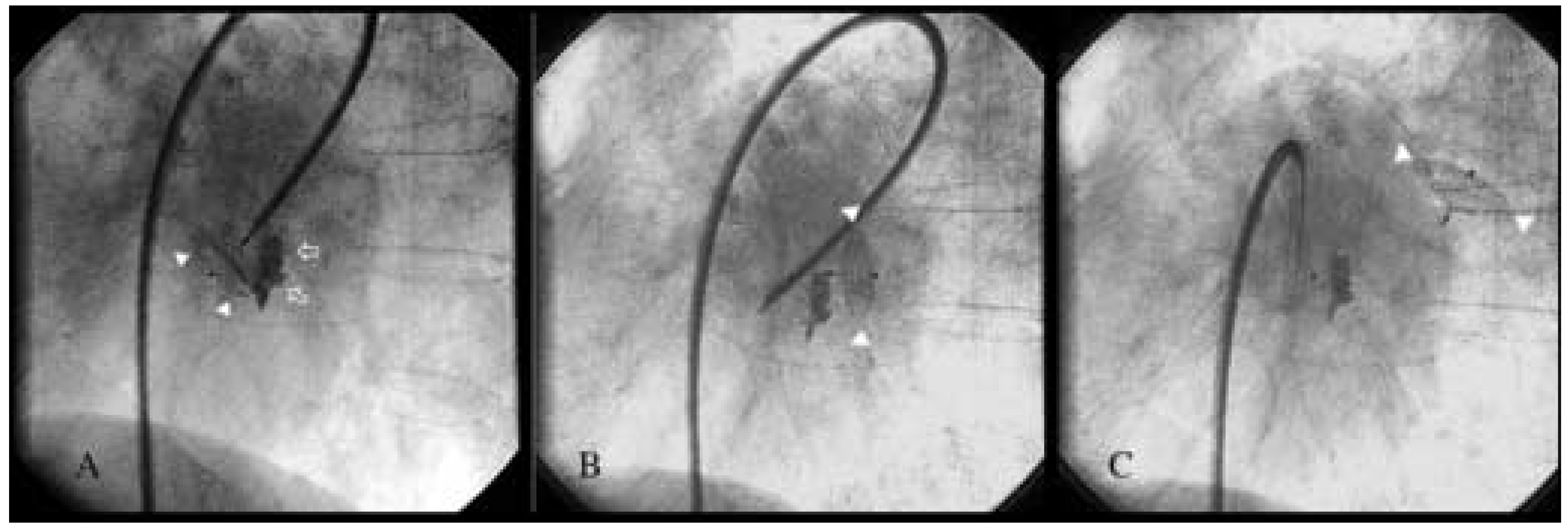 Cardiovascmed 07 00033 g001