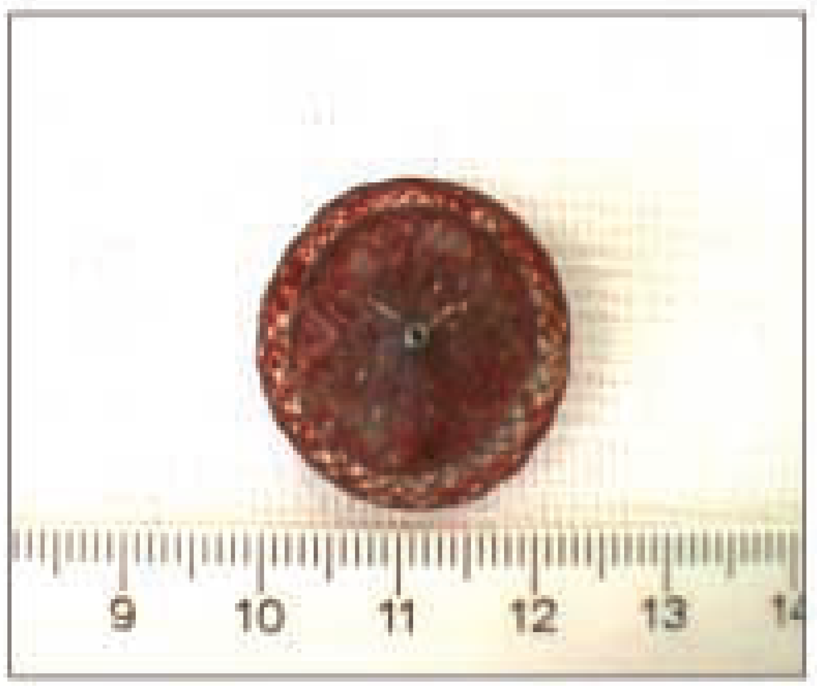 Cardiovascmed 07 00033 g003