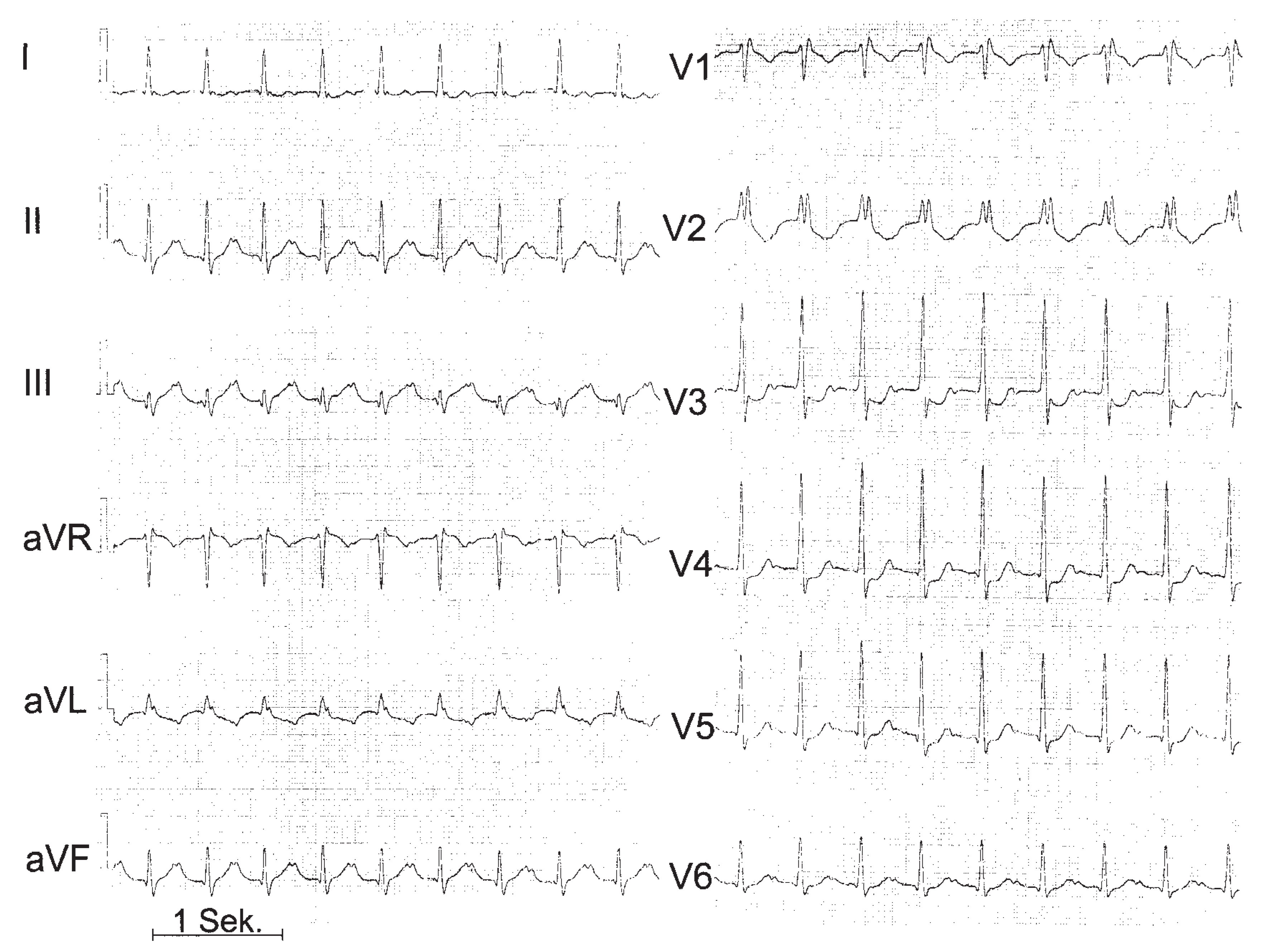 Cardiovascmed 07 00036 g001
