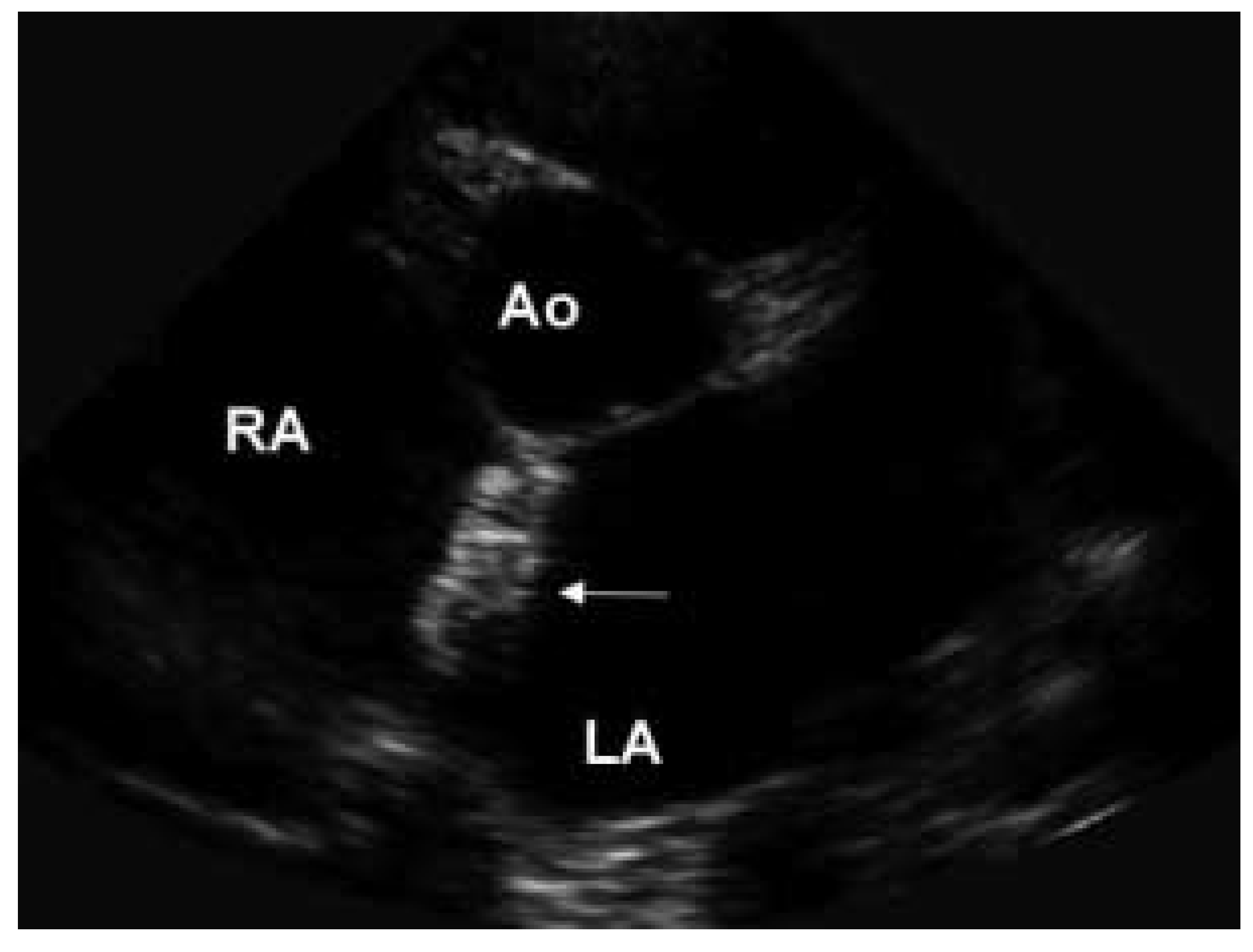 Cardiovascmed 07 00038 g001