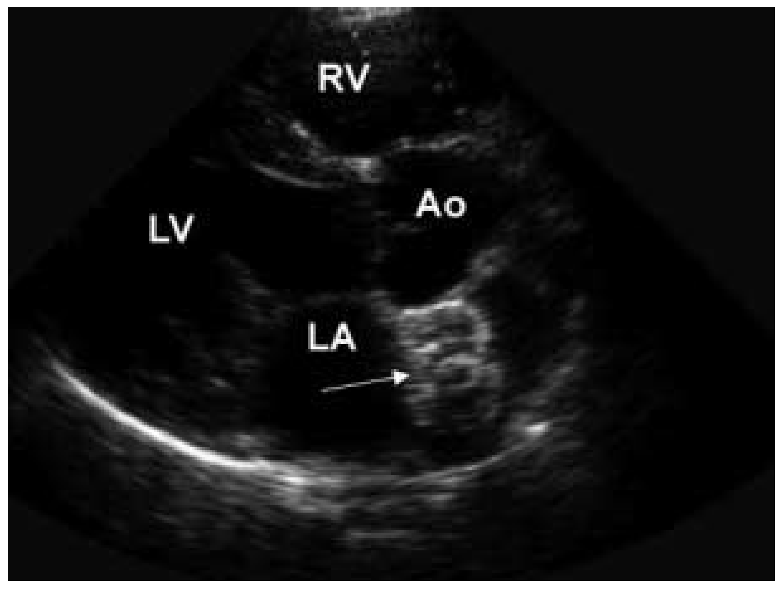 Cardiovascmed 07 00038 g002
