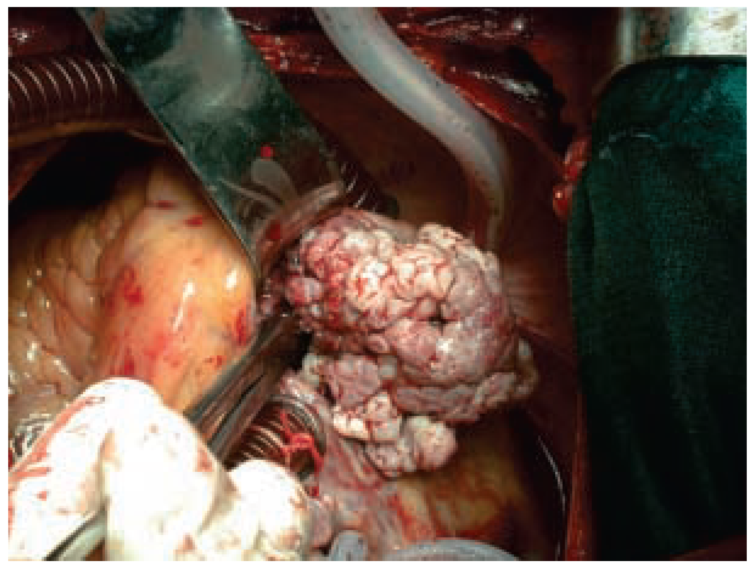 Cardiovascmed 07 00088 g003