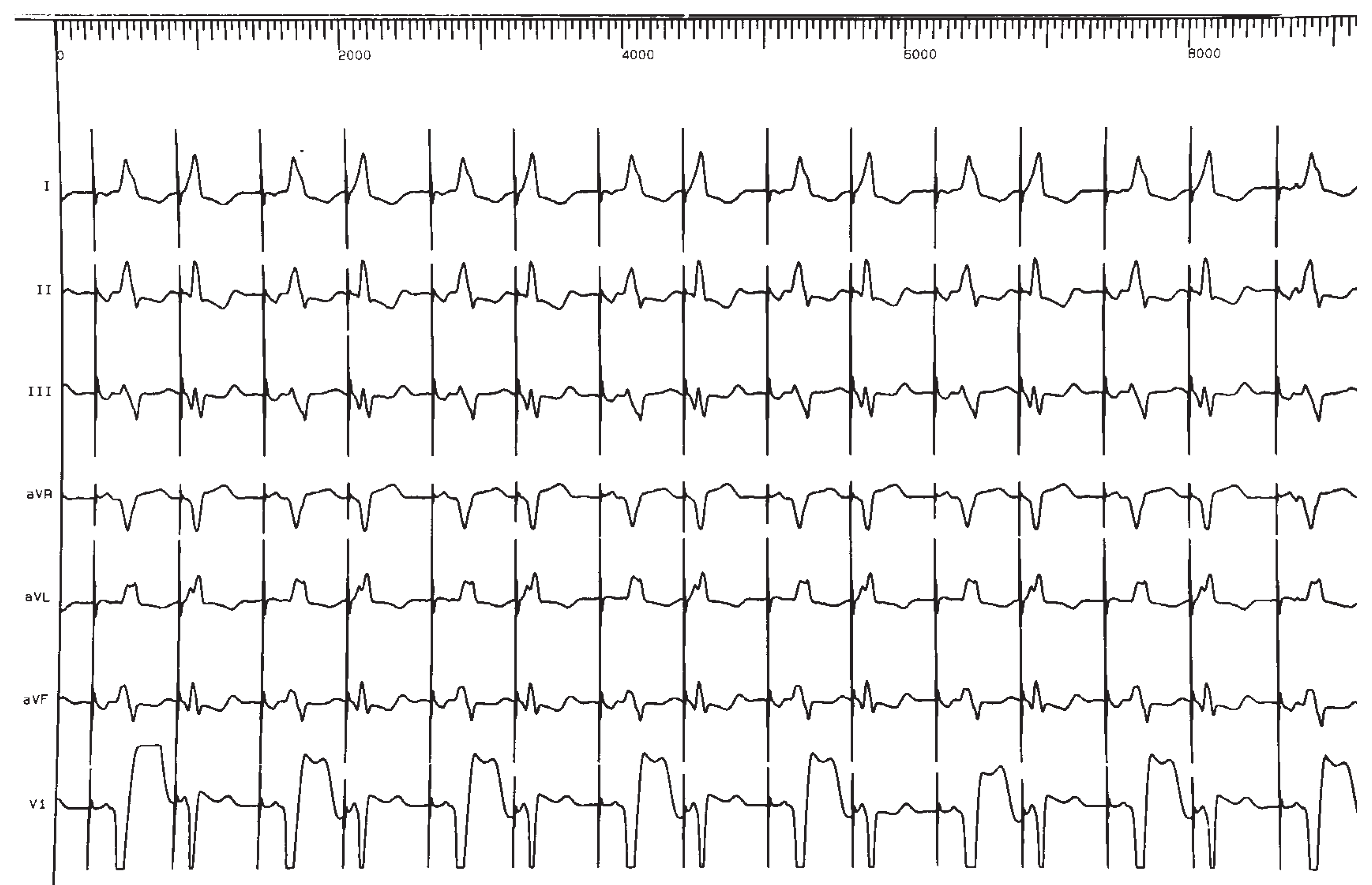 Cardiovascmed 07 00097 i001