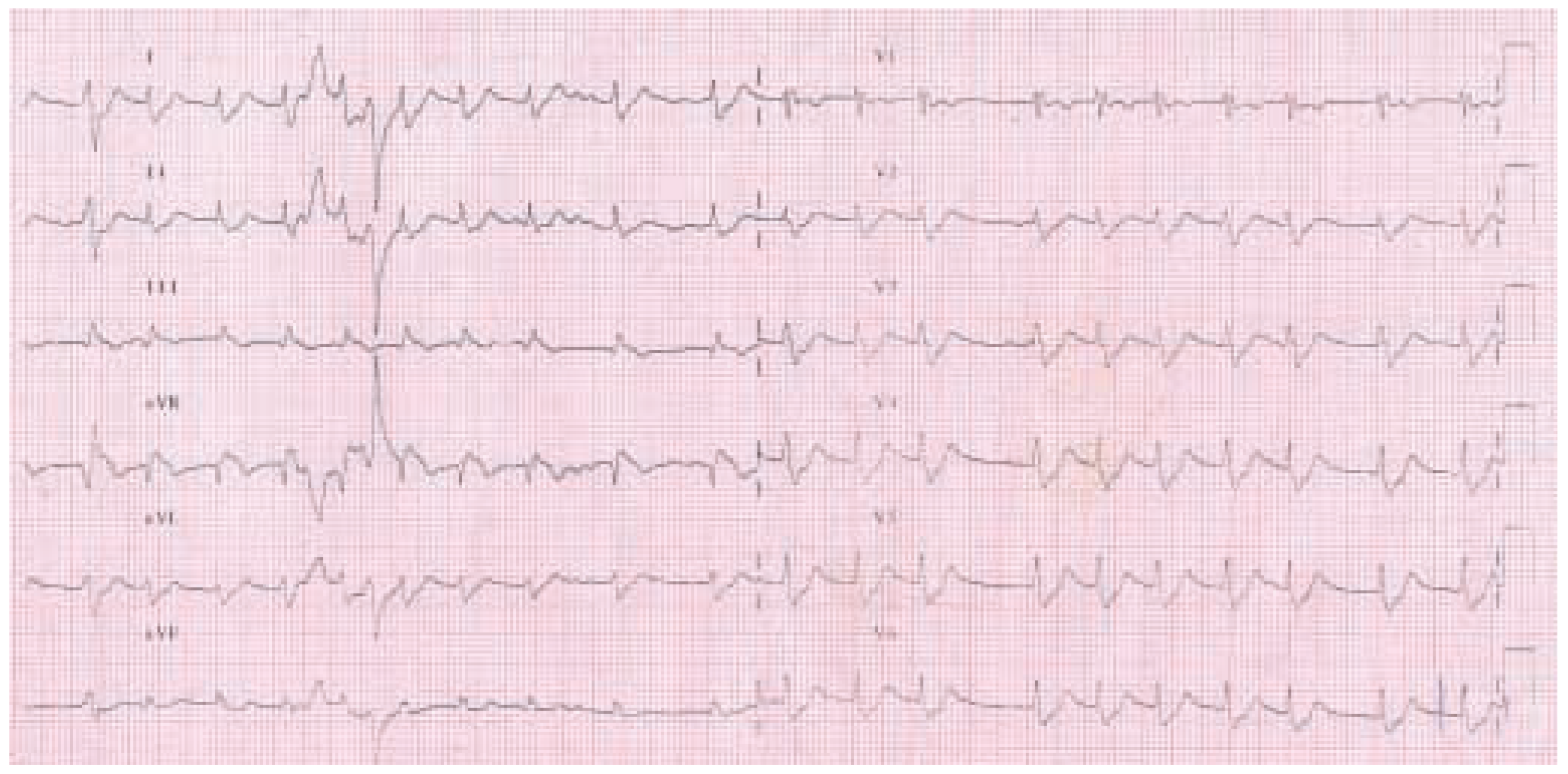 Cardiovascmed 07 00136 g001 Cardiovascmed 07 00136 g001