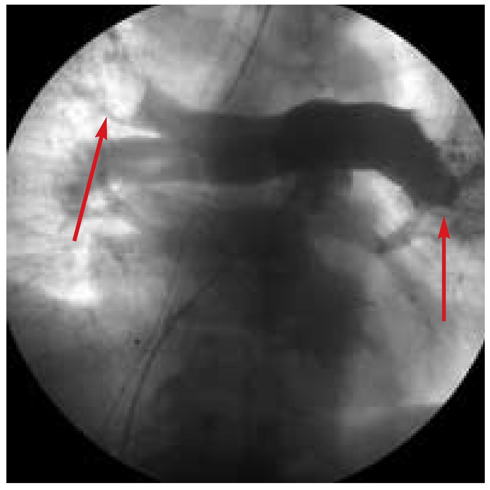 Cardiovascmed 07 00136 g002 Cardiovascmed 07 00136 g002