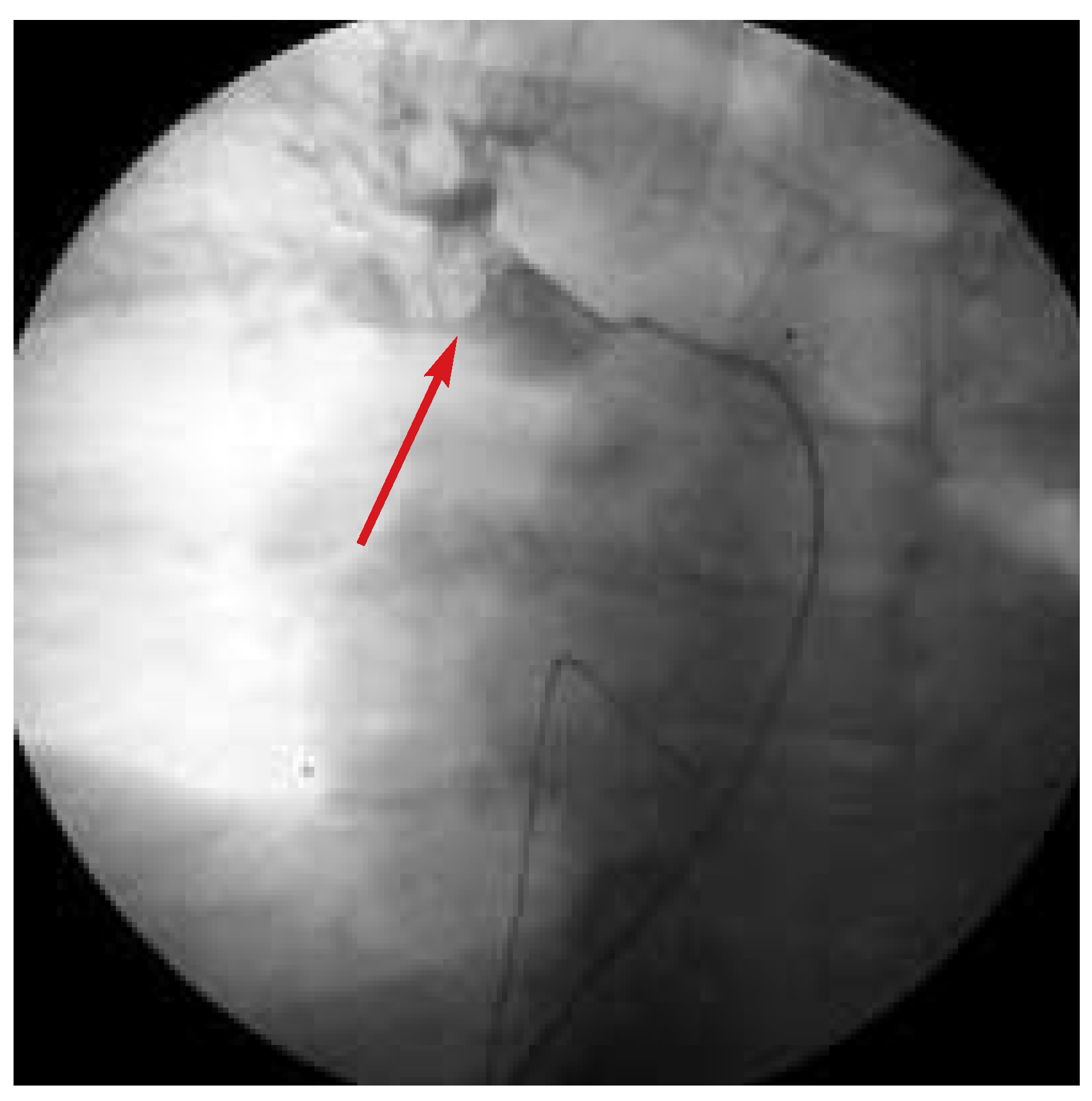 Cardiovascmed 07 00136 g003 Cardiovascmed 07 00136 g003