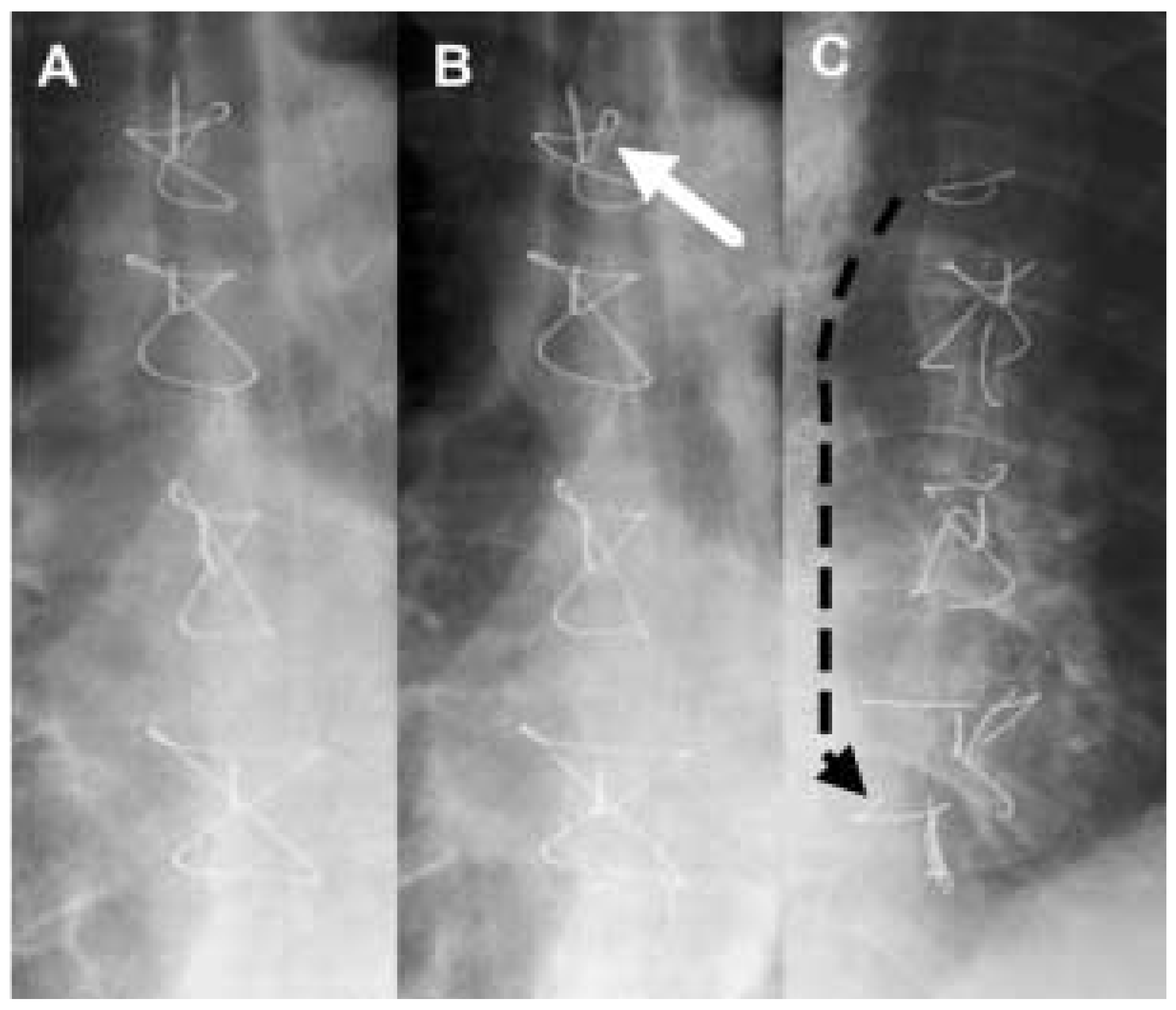 Cardiovascmed 07 00140 g001 Cardiovascmed 07 00140 g001