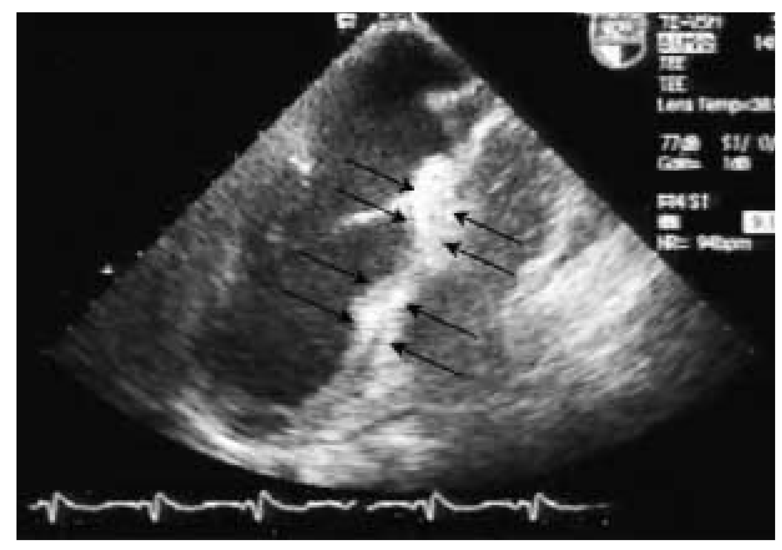 Cardiovascmed 07 00185 g001