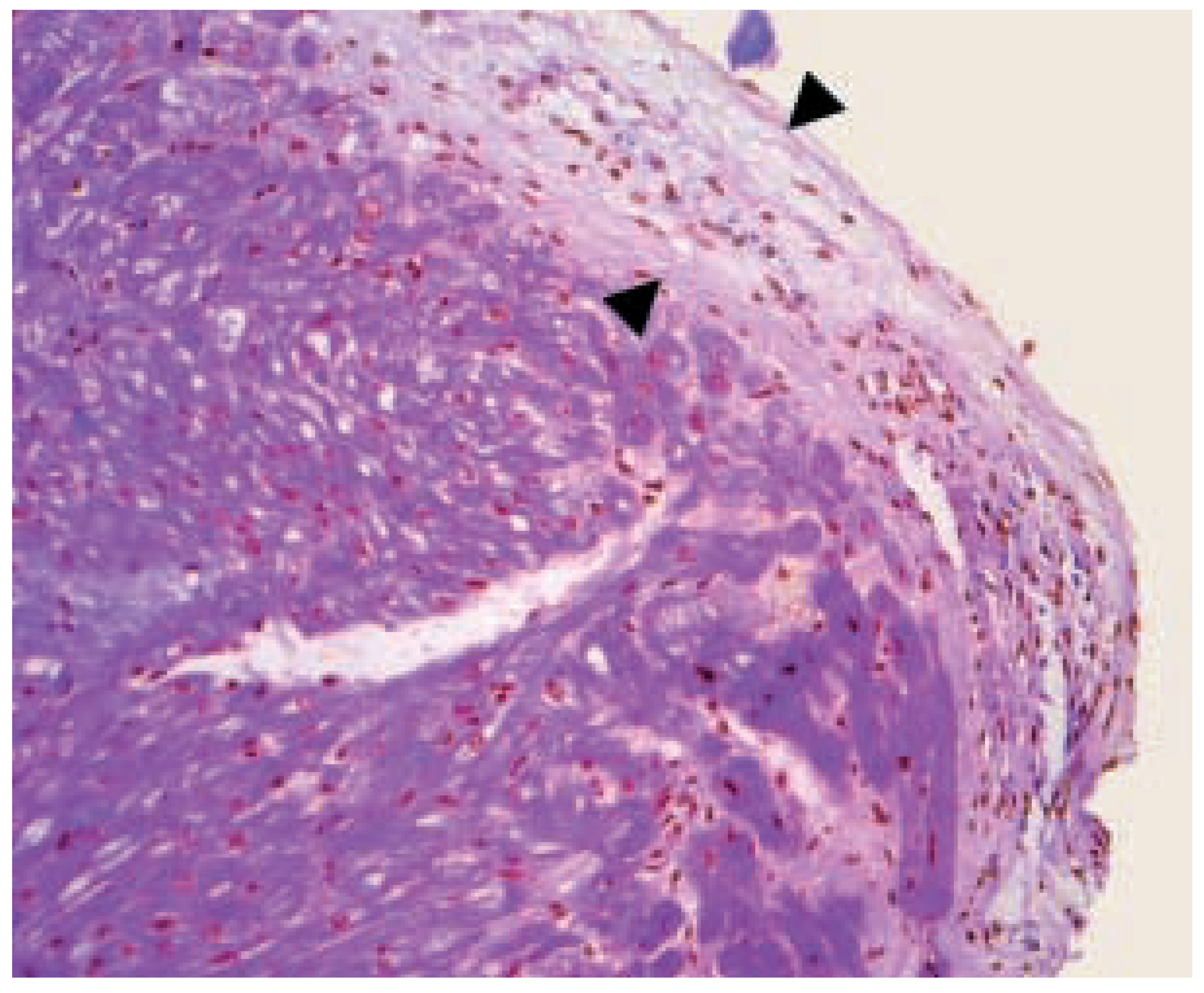 Cardiovascmed 07 00185 g002