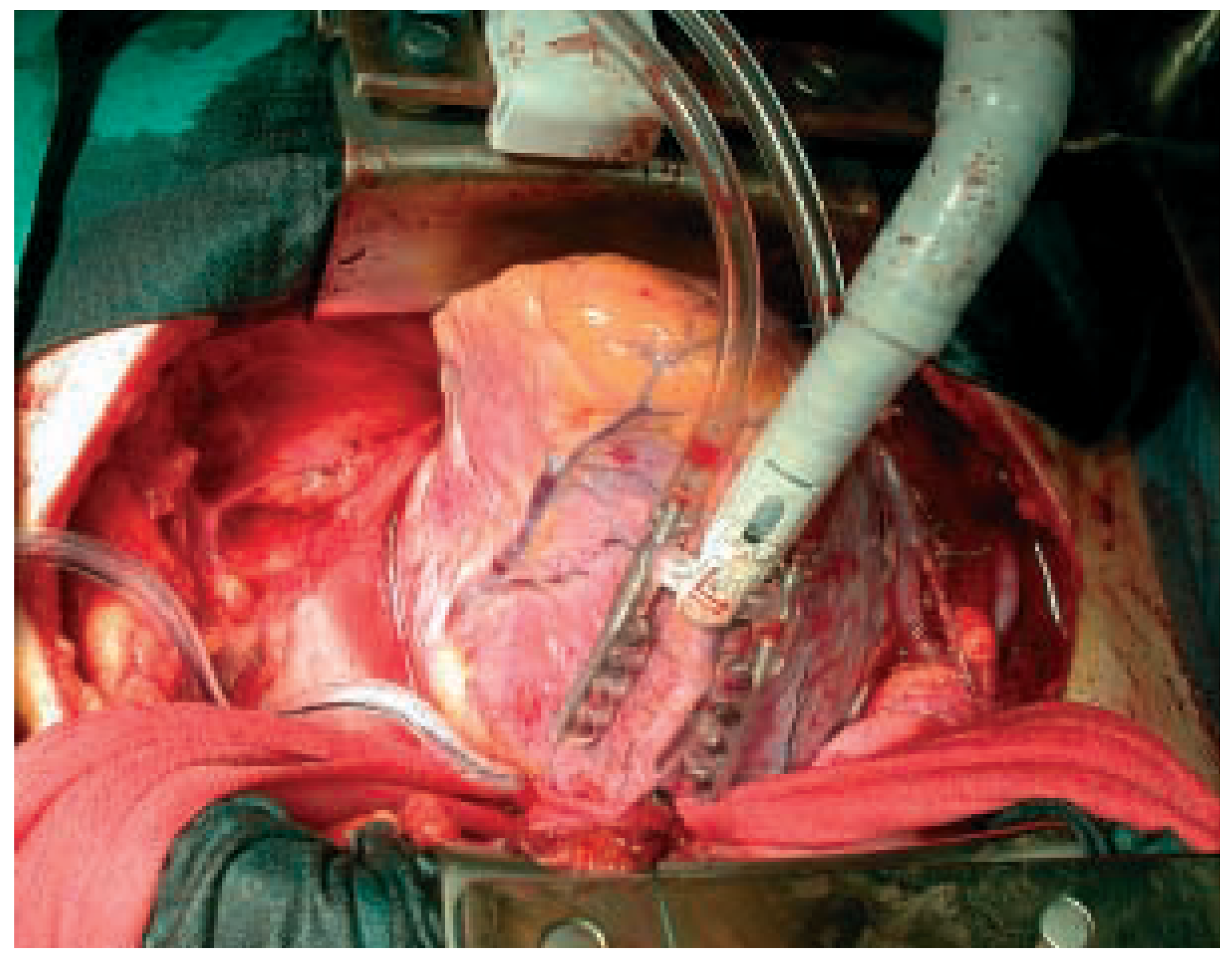 Cardiovascmed 07 00214 g001 Cardiovascmed 07 00214 g001