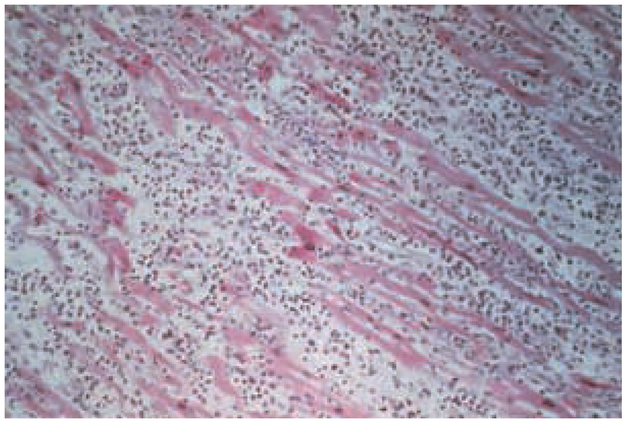 Cardiovascmed 07 00248 g001 Cardiovascmed 07 00248 g001