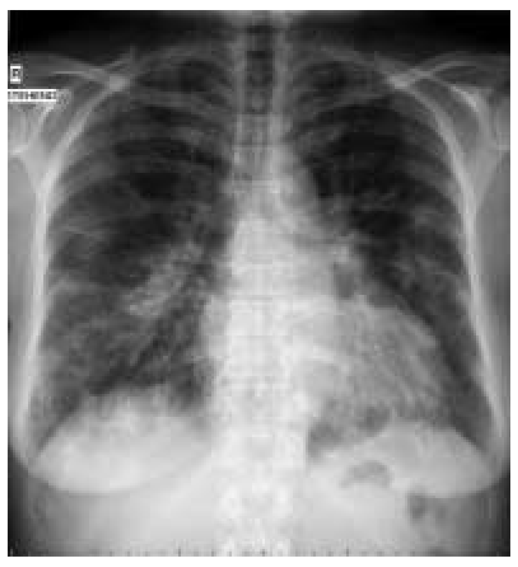 Cardiovascmed 07 00269 g001