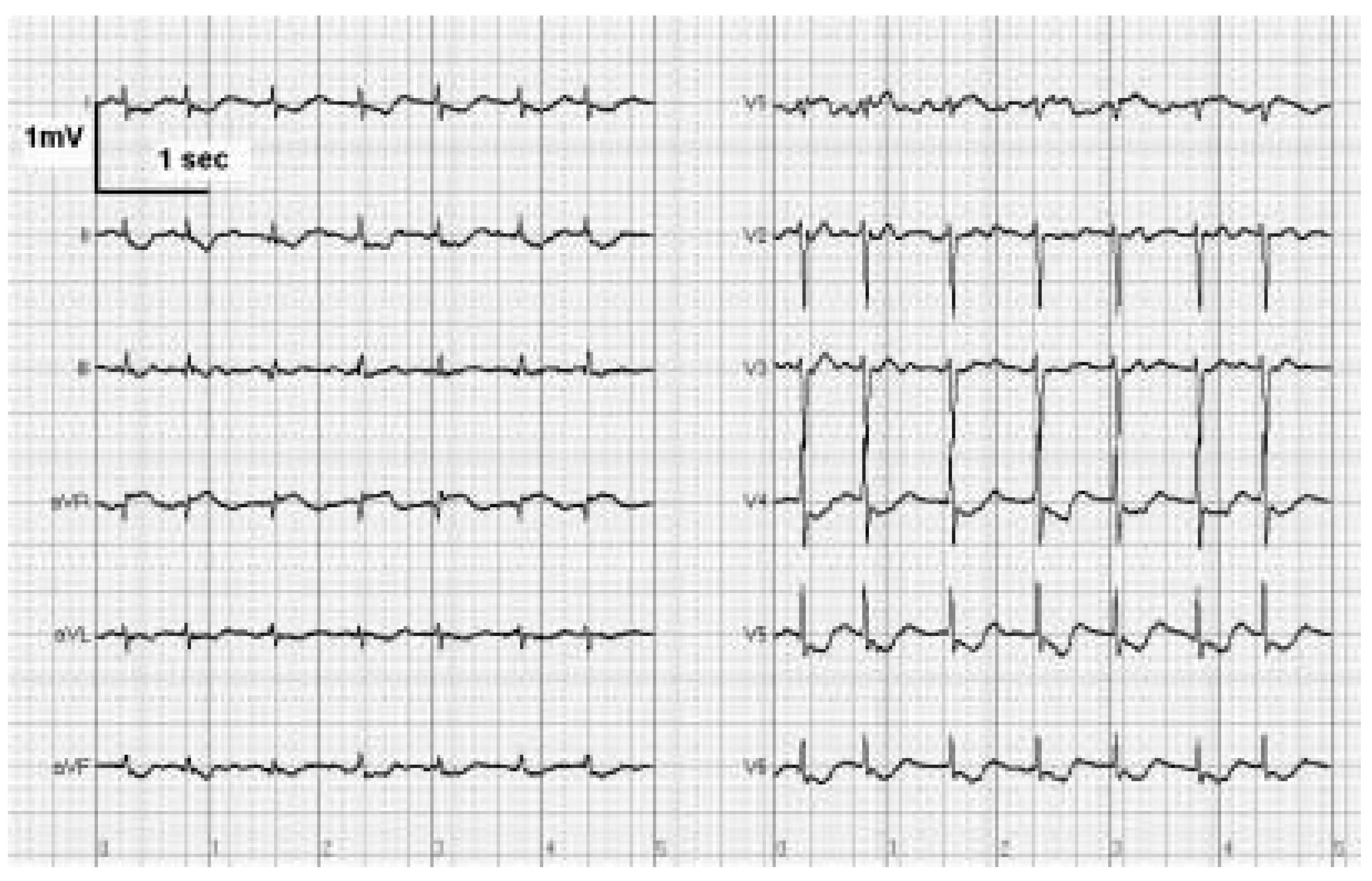 Cardiovascmed 07 00269 g002