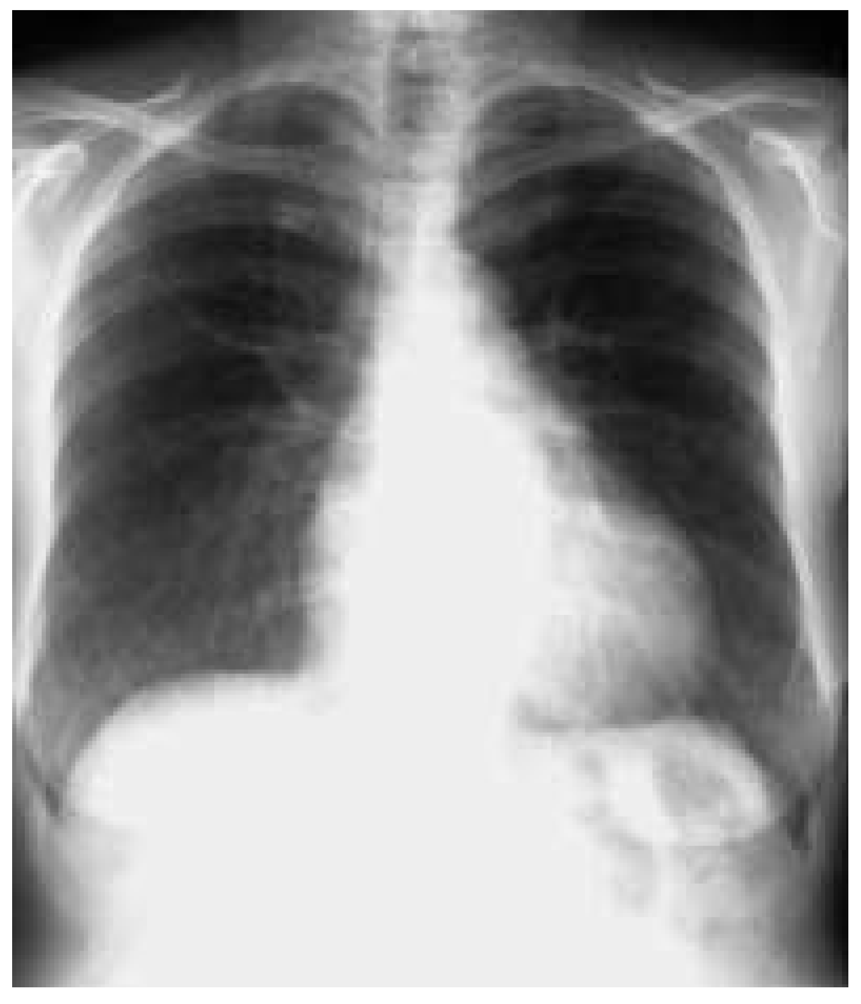 Cardiovascmed 07 00269 g003