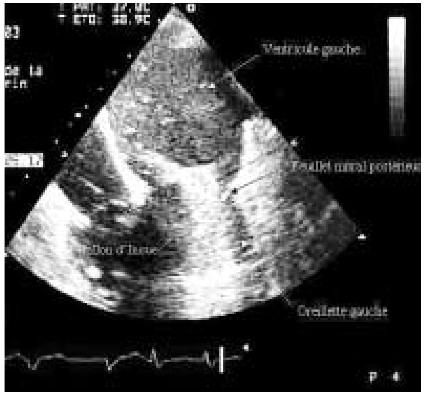 Cardiovascmed 07 00337 g002