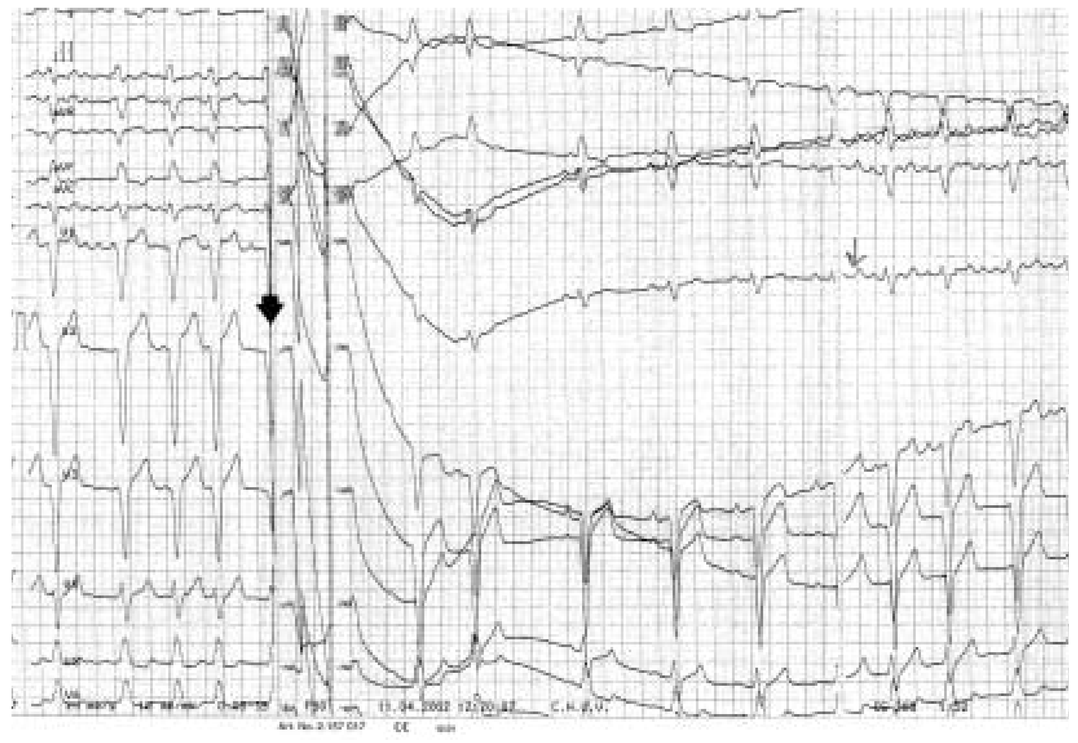 Cardiovascmed 07 00341 g001 Cardiovascmed 07 00341 g001