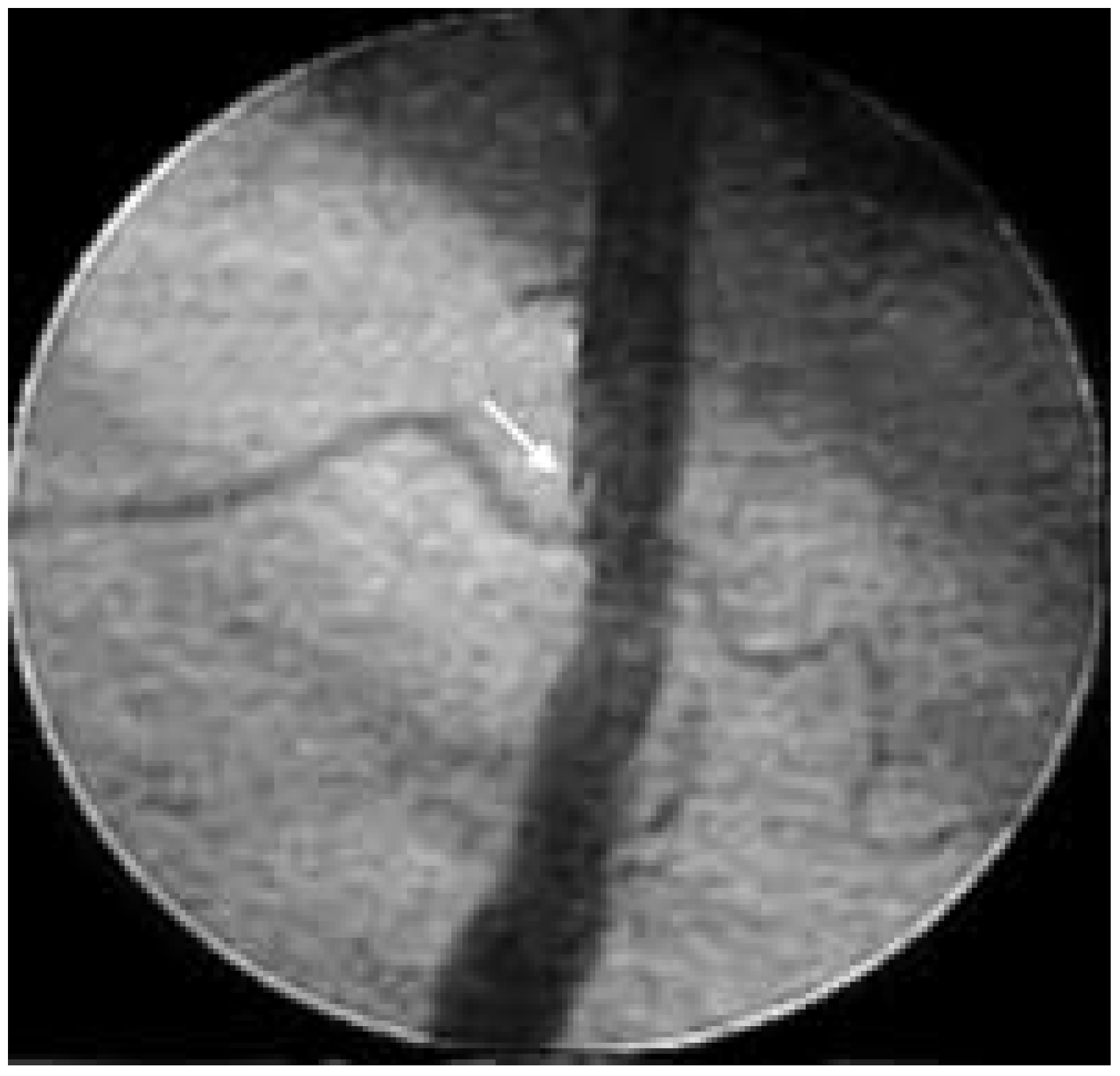 Cardiovascmed 07 00349 g001 Cardiovascmed 07 00349 g001